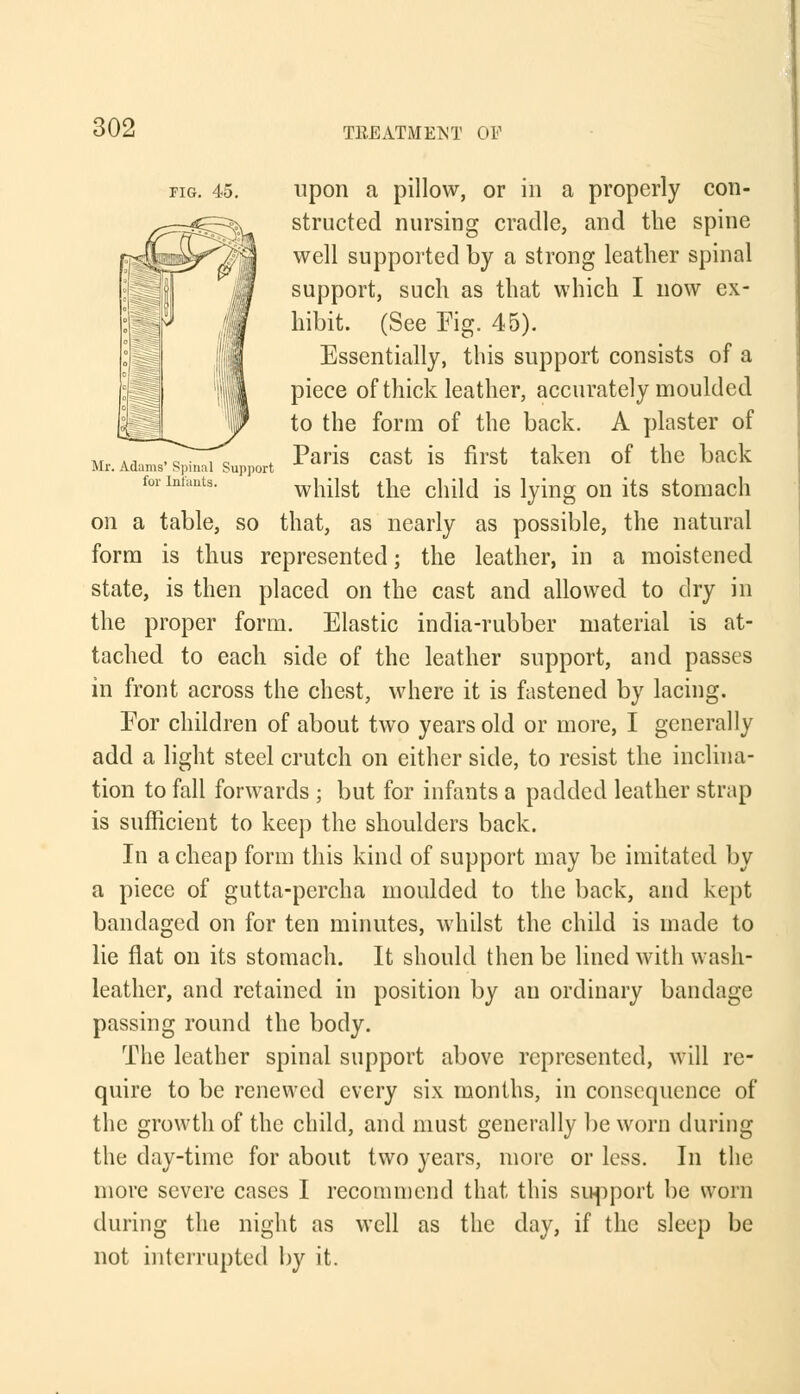 fig. 45. upon a pillow, or in a properly con- structed nursing cradle, and the spine well supported by a strong leather spinal support, such as that which I now ex- hibit. (See Fig. 45). Essentially, this support consists of a piece of thick leather, accurately moulded to the form of the back. A plaster of . Paris cast is first taken of the back to infants. y?hM the child is lying on its stomach on a table, so that, as nearly as possible, the natural form is thus represented; the leather, in a moistened state, is then placed on the cast and allowed to dry in the proper form. Elastic india-rubber material is at- tached to each side of the leather support, and passes in front across the chest, where it is fastened by lacing. Eor children of about two years old or more, I generally add a light steel crutch on either side, to resist the inclina- tion to fall forwards ; but for infants a padded leather strap is sufficient to keep the shoulders back. In a cheap form this kind of support may be imitated by a piece of gutta-percha moulded to the back, and kept bandaged on for ten minutes, whilst the child is made to lie flat on its stomach. It should then be lined with wash- leather, and retained in position by an ordinary bandage passing round the body. The leather spinal support above represented, will re- quire to be renewed every six months, in consequence of the growth of the child, and must generally be worn during the day-time for about two years, more or less. In the more severe cases I recommend that this support be worn during the night as well as the day, if the sleep be not interrupted by it.