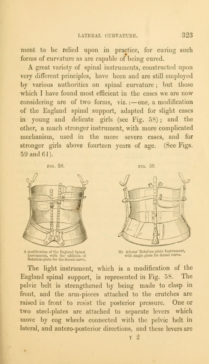 merit to be relied upon in practice, for curing such forms of curvature as are capable of being cured. A great variety of spinal instruments, constructed upon very different principles, have been and are still employed by various authorities on spinal curvature; but those which I have found most efficient in the cases we are now considering are of two forms, viz.:—one, a modification of the Eagland spinal support, adapted for slight cases in young and delicate girls (see Fig. 58) ; and the other, a much stronger instrument, with more complicated mechanism, used in the more severe cases, and for stronger girls above fourteen years of age. (See Figs. 59 and 61). FIG. 58. FIG. 59. A modification of the Eagland Spinal Instrument, with the addition of Rotation-plate for the dorsal curve. Mr Adams' Rotation-plate Instrument, with single plate for dorsal cone. The light instrument, which is a modification of the Eagland spinal support, is represented in Fig. 58. The pelvic belt is strengthened by being made to clasp in front, and the arm-pieces attached to the crutches are raised in front to resist the posterior pressure. One or two steel-plates are attached to separate levers which move by cog wheels connected with the pelvic belt in lateral, and antero-posterior directions, and these levers are t 2