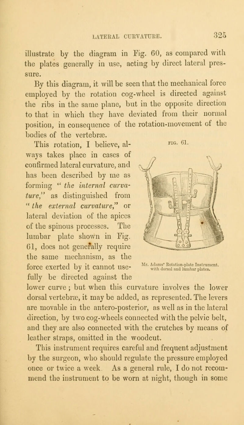 :52.'> FIG. 61. illustrate by the diagram in Fig. GO, as compared with the plates generally in use, acting by direct lateral pres- sure. By this diagram, it will be seen that the mechanical force employed by the rotation cog-wheel is directed against the ribs in the same plane, but in the opposite direction to that in which they have deviated from their normal position, in consequence of the rotation-movement of the bodies of the vertebrae. This rotation, I believe, al- ways takes place in cases of confirmed lateral curvature, and has been described by me as forming  the internal curva- ture as distinguished from  the external curvature, or lateral deviation of the apices of the spinous processes. The lumbar plate shown in Fig. 61, does not generally require the same mechanism, as the force exerted by it cannot use- fully be directed against the lower curve; but when this curvature involves the lower dorsal vertebras, it maybe added, as represented. The levers are movable in the antero-posterior, as well as in the lateral direction, by two cog-wheels connected with the pelvic belt, and they are also connected with the crutches by means of leather straps, omitted in the woodcut. This instrument requires careful and frequent adjustment by the surgeon, who should regulate the pressure employed once or twice a week. As a general rule, I do not recom- mend the instrument to be worn at night, though in some Mr. Adams' Rotation-plate Instrument. with dorsal and lumbar plates.