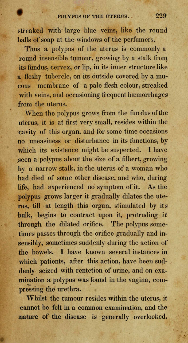 streaked with large blue veins, like the round balls of soap at the windows of the perfumers. Thus a polypus of the uterus is commonly a round insensible tumour, growing by a stalk from its fundus, cervex, or lip, in its inner structure like a fleshy tubercle, on its outside covered by a mu- cous membrane of a pale flesh colour, streaked with veins, and occasioning frequent haemorrhages from the uterus. When the polypus grows from the fundus of the uterus, it is at first very small, resides within the cavity of this organ, and for some time occasions no uneasiness or disturbance in its functions, by which its existence might be suspected. I have seen a polypus about the size of a filbert, growing by a narrow stalk, in the uterus of a woman who had died of some other disease, and who, during life, had experienced no symptom of it. As the polypus grows larger it gradually dilates the ute- rus, till at length this organ, stimulated by its bulk, begins to contract upon it, protruding it through the dilated orifice. The polypus some- times passes through the orifice gradually and in- sensibly, sometimes suddenly during the action of the bowels. I have known several instances in which patients, after this action, have been sud- denly seized with rentetion of urine, and on exa- mination a polypus was found in the vagina, com- pressing the urethra. Whilst the tumour resides within the uterus, it cannot be felt in a common examination, and the nature of the disease is generally overlooked.