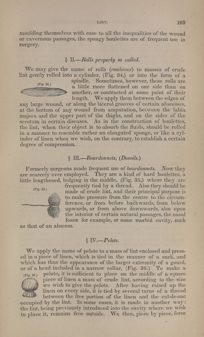 moulding themselves with ease to all the inequalities of the wound or cavernous passages, the spongy boulettes are of frequent use in surgery. § II.—Rolls properly so called. We may give the name of rolls {rouleaux) to masses of crude lint gently rolled into a cylinder, (Fig. 34,) or into the form of a spindle. Sometimes, however, these rolls are a little more flattened on one side than on another, or contracted at some point of their length. We apply them between the edges of any large wound, or along the lateral grooves of certain abscesses, at the bottom of any wound from amputation, between the labia majora and the upper part of the thighs, and on the sides of the scrotum in certain diseases. As in the construction of boulettes, the lint, when their object is to absorb the fluids, should be rolled in a manner to resemble rather an elongated sponge, or like a cyl- inder of linen when we wish, on the contrary, to establish a certain degree of compression. § III.—Bourdonnets, (Dossils.) Formerly surgeons made frequent use of bourdonnets. Now they are scarcely ever employed. They are a kind of hard boulettes, a little lengthened, bulging in the middle, (Fig. 35,) where they are frequently tied by a thread. Also they should be (F\a 35 ) ^ made of crude lint, and their principal purpose is mmn *° ma^e pressure from the centre to the circum- „ wjl$0 ference, or from before backwards, from below MppL upwards, or from above downwards, also upon iB||f the interior of certain natural passages, the nasal fossae for example, or some morbid cavity, such as that of an abscess. § IV.—Pelote. We apply the name of pelote to a mass of lint enclosed and press- ed in a piece of linen, which is tied in the manner of a sack, and which has thus the appearance of the larger extremity of a gourd, or of a head included in a narrow collar, (Fig. 36.) To make a (Fig. 36.) pelote, it is sufficient to place on the middle of a square piece of linen a mass of crude lint, according to the size we wish to give the pelote. After having raised up the linen on every side, it is tied by several turns of a thread between the free portion of the linen and the cul-de-sac occupied by the lint. In some cases, it is made in another way: the lint, being previously introduced into the cavity where we wish to place it, remains free outside. We then, piece by piece, force