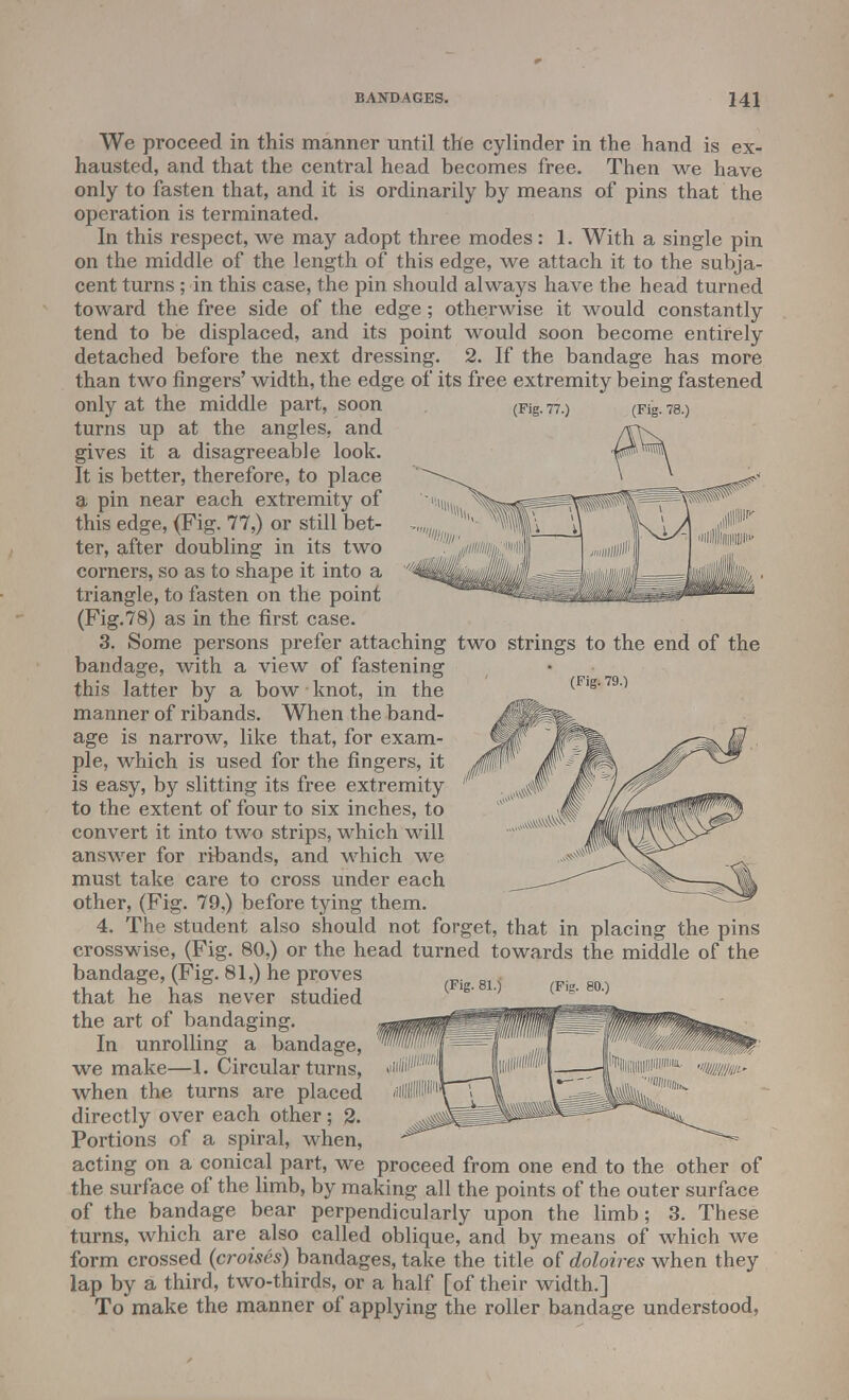 (Fig. 77.) (Fig. 78.) We proceed in this manner until the cylinder in the hand is ex- hausted, and that the central head becomes free. Then we have only to fasten that, and it is ordinarily by means of pins that the operation is terminated. In this respect, we may adopt three modes: 1. With a single pin on the middle of the length of this edge, we attach it to the subja- cent turns ; in this case, the pin should always have the head turned toward the free side of the edge ; otherwise it would constantly tend to be displaced, and its point would soon become entirely detached before the next dressing. 2. If the bandage has more than two fingers' width, the edge of its free extremity being fastened only at the middle part, soon turns up at the angles, and gives it a disagreeable look. It is better, therefore, to place a pin near each extremity of this edge, (Fig. 77,) or still bet- ter, after doubling in its two corners, so as to shape it into a triangle, to fasten on the point (Fig.78) as in the first case. 3. Some persons prefer attaching two strings to the end of the bandage, with a view of fastening this latter by a bow knot, in the manner of ribands. When the band- age is narrow, like that, for exam- ple, which is used for the fingers, it is easy, by slitting its free extremity to the extent of four to six inches, to convert it into two strips, which will answer for ribands, and which we must take care to cross under each other, (Fig. 79,) before tying them. 4. The student also should not forget, that in placing the pins crosswise, (Fig. 80,) or the head turned towards the middle of the bandage, (Fig. 81,) he proves (Fig. 79.) (Fig. 81.) (Fig. 80.) that he has never studied the art of bandaging. In unrolling a bandage, we make—1. Circular turns, when the turns are placed directly over each other; 2. Portions of a spiral, when, acting on a conical part, we proceed from one end to the other of the surface of the limb, by making all the points of the outer surface of the bandage bear perpendicularly upon the limb; 3. These turns, which are also called oblique, and by means of which we form crossed (croises) bandages, take the title of doloires when they lap by a third, two-thirds, or a half [of their width.] To make the manner of applying the roller bandage understood,