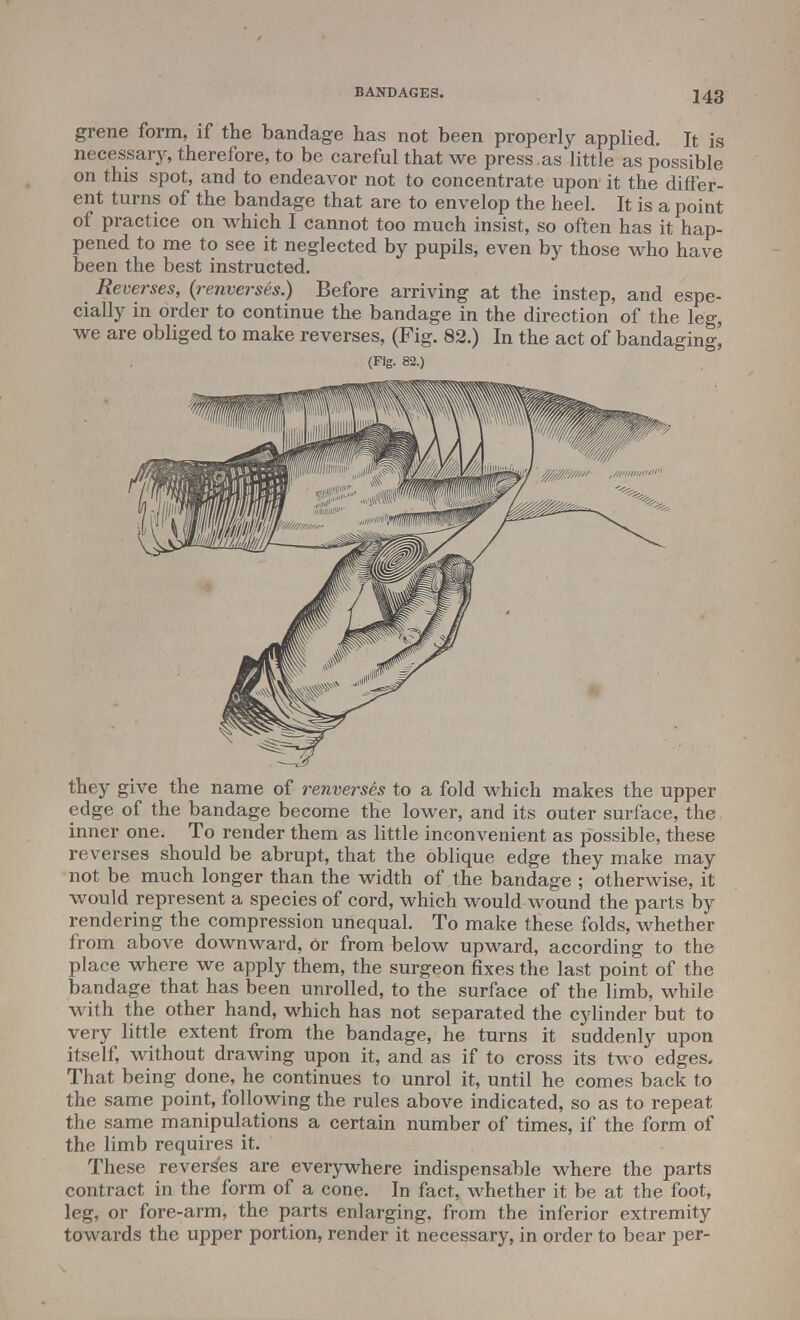 grene form, if the bandage has not been properly applied. It is necessary, therefore, to be careful that we press.as little as possible on this spot, and to endeavor not to concentrate upon it the differ- ent turns of the bandage that are to envelop the heel. It is a point of practice on which I cannot too much insist, so often has it hap- pened to me to see it neglected by pupils, even by those who have been the best instructed. Reverses, (renverses.) Before arriving at the instep, and espe- cially in order to continue the bandage in the direction of the leg, we are obliged to make reverses, (Fig. 82.) In the act of bandaging, (Fig. 82.) they give the name of renverse's to a fold which makes the upper edge of the bandage become the lower, and its outer surface, the inner one. To render them as little inconvenient as possible, these reverses should be abrupt, that the oblique edge they make may not be much longer than the width of the bandage ; otherwise, it would represent a species of cord, which would wound the parts by rendering the compression unequal. To make these folds, whether from above downward, Or from below upward, according to the place where we apply them, the surgeon fixes the last point of the bandage that has been unrolled, to the surface of the limb, while with the other hand, which has not separated the cylinder but to very little extent from the bandage, he turns it suddenly upon itself, without drawing upon it, and as if to cross its two edges. That being done, he continues to unrol it, until he comes back to the same point, following the rules above indicated, so as to repeat the same manipulations a certain number of times, if the form of the limb requires it. These reverses are everywhere indispensable where the parts contract in the form of a cone. In fact, whether it be at the foot, leg, or fore-arm, the parts enlarging, from the inferior extremity towards the upper portion, render it necessary, in order to bear per-