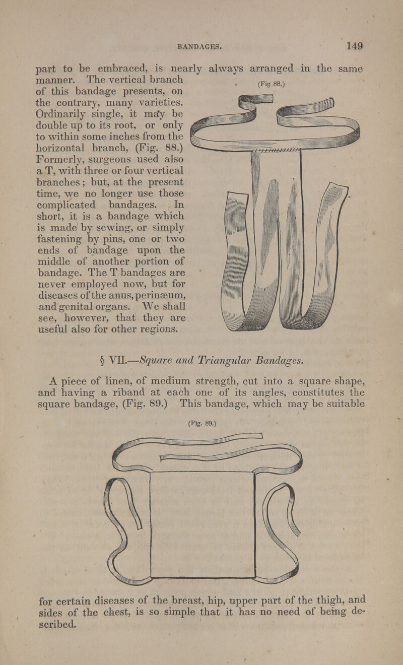 part to be embraced, is nearly always arranged in the same manner. The vertical branch of this bandage presents, on the contrary, many varieties. Ordinarily single, it ma*y be double up to its root, or only to within some inches from the horizontal branch, (Fig. 88.) Formerly, surgeons used also a T, with three or four vertical branches; but, at the present time, we no longer use those complicated bandages. In short, it is a bandage which is made by sewing, or simply fastening by pins, one or two ends of bandage upon the middle of another portion of bandage. The T bandages are never employed now, but for diseases of the anus,perinaeurn, and genital organs. We shall see, however, that they are useful also for other regions. § VII.—Square and Triangular Bandages. A piece of linen, of medium strength, cut into a square shape, and having a riband at each one of its angles, constitutes the square bandage, (Fig. 89.) This bandage, which may be suitable (Pig. 89.) for certain diseases of the breast, hip, upper part of the thigh, and sides of the chest, is so simple that it has no need of being de- scribed.