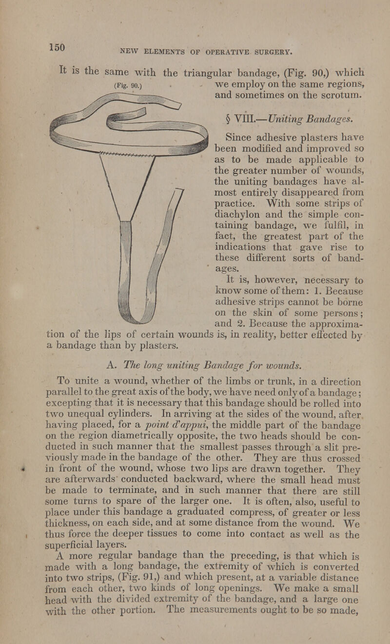 NEW ELEMENTS OF OPERATIVE SURGERY. It is the same with the triangular bandage, (Fig. 90,) which (Pig. 90.) • - we employ on the same regions, and sometimes on the scrotum. § VIII.—Uniting Bandages. Since adhesive plasters have been modified and improved so as to be made applicable to the greater number of wounds, the uniting bandages have al- most entirely disappeared from practice. With some strips of diachylon and the simple con- taining bandage, we fulfil, in fact, the greatest part of the indications that gave rise to these different sorts of band- ages. It is, however, necessary to know some of them: 1. Because adhesive strips cannot be borne on the skin of some persons; and 2. Because the approxima- tion of the lips of certain wounds is, in reality, better effected by a bandage than by plasters. A. Tlie long uniting Bandage for wounds. To unite a wound, whether of the limbs or trunk, in a direction parallel to the great axis of the body, we have need only of a bandage; excepting that it is necessary that this bandage should be rolled into two unequal cylinders. In arriving at the sides of the wound, after, having placed, for a point d'appui, the middle part of the bandage on the region diametrically opposite, the two heads should be con- ducted in such manner that the smallest passes through a slit pre- viously made in the bandage of the other. They are thus crossed in front of the wound, whose two lips are drawn together. They are afterwards' conducted backward, where the small head must be made to terminate, and in such manner that there are still some turns to spare of the larger one. It is often, also, useful to place under this bandage a graduated compress, of greater or less thickness, on each side, and at some distance from the wound. We i thus force the deeper tissues to come into contact as well as the superficial layers. A more regular bandage than the preceding, is that which is made with a long bandage, the extremity of which is converted into two strips, (Fig. 91,) and which present, at a variable distance from each other, two kinds of long openings. We make a small head with the divided extremity of the bandage, and a large one with the other portion. The measurements ought to be so made,