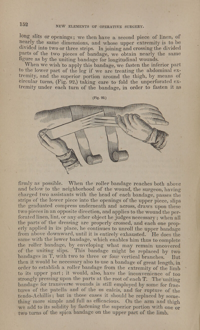 NEW ELEMENTS OF OPERATIVE SURGERY. long slits or openings; we then have a second piece of linen, of nearly the same dimensions, and whose upper extremity is to be divided into two or three strips. In joining and crossing the divided parts of the two pieces of bandage, we obtain nearly the same figure as by the uniting bandage for longitudinal wounds. When we wish to apply this bandage, we fasten the inferior part- to the lower part of the leg if we are treating the abdominal ex- tremity, and the superior portion around the thigh, by means of circular turns, (Fig. 92,) taking care to fold the unperforated ex- tremity under each turn of the bandage, in order to fasten it as (Fig. 92.) firmly as possible. When the roller bandage reaches both above and below to the neighborhood of the wound, the surgeon, having charged two assistants with the head of each bandage, passes the strips of the lower piece into the openings of the upper piece, slips the graduated compress underneath and across, draws upon these two pieces in an opposite direction, and applies to the wound the per- forated linen, lint, or any other object he judges necessary; when all the parts of the dressing are properly crossed, and each one prop- erly applied in its place, he continues to unroll the upper bandage from above downward, until it is entirely exhausted. He does the same with the lower bandage, which enables him thus to complete the roller bandage, by enveloping what may remain uncovered of the uniting slips. This bandage might be replaced by two bandages in T, with two to three or four vertical branches. But then it would be necessary also to use a bandage of great length, in order to establish a roller bandage from the extremity of the limb to its upper part; it would, also, have the inconvenience of too strongly pressing upon the parts at the root of each T. The uniting bandage for transverse wounds is still employed by some for frac° tures of the patella and of the os calcis, and for rupture of the tendo-Achillis; but in those cases it should be replaced by some- thing more simple and full as efficacious. On the arm and thigh we add to its solidity by fastening the superior portion with one or two turns of the spica bandage on the upper part of the limb.