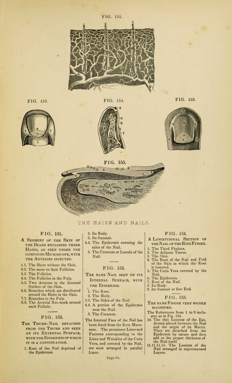 FIG. 152. FIG. 153. FIG. 155. THE HAIRS AND NAILS. FIG. 151. A Segment of the Skin of the Beard enclosing three Hairs, as seen under the compound Microscope, with the Arteries injected. 1.1. The Hairs without the Skin. 2.2. The same in their Follicles. 3.3. The Follicles. 4.4. The Follicles in the Pulp. 5.5. Two Arteries in the Internal Surface of the Skin. 6.6. Branches which are distributed around the Hairs in the Skin. 7.7. Branches to the Pulp. 8.8. The Arterial Net-work around each Follicle. FIG. 152. The Thumb-Nail detached from the Thumb and seen on its External Surface, with the Epidermis of which it is a continuation. 1. Root of the Nail deprived of the Epidermis. 2. Its Body. 3. Its Summit. 4.4. The Epidermis covering the sides of the Nail. 5. The Crescent or Lunula of the Nail. FIG. 153. The same Nail seen on its Internal Surface, with the Epidermis. 1. The Root. 2. The Body. 3.3. The Sides of the Nail. 4.4. A portion of the Epidermis near the Nail. 5. The Crescent. The Internal Face of the Nail has been freed from the Rete Muco- sum. The prominent Lines and Furrows corresponding to the Lines and Wrinkles of the Cutis Vera, and covered by the Nail, are seen arranged in parallel 1. 2. I3/ (, 4. FIG. 154. Longitudinal Section of the Nail of the Ring Finger. The Third Phalanx. The Adipose Tissue. The Skin. The Root of the Nail of the Skin in which is inserted. The Cutis Vera covered by the Nail. The Epidermis. Root of the Nail. Its Body. Its Summit or free End. and Fold the Root Lines. FIG. 155. The same Figure very highly magnified. The References from 1 to 9 inclu- sive as in Fig. 154. 10. The thin Laminae of the Epi- dermis placed between the Nail and the origin of its Matrix. They are detached from the Epidermis by nature and then add to the proper thickness of the Nail itself. 11.11.11.11. The Laminae of the Nail arranged in superimposed Layers. Fage 66.