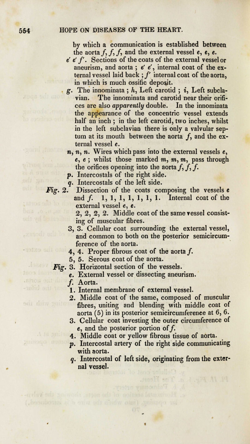 by which a communication is established between the aorta/,/,/, and the external vessel c, e, e. e t' /'. Sections of the coats of the external vessel or aneurism, and aorta ; e' e', internal coat of the ex- ternal vessel laid back ; /' internal coat of the aorta, in which is much ossific deposit. . g. The innominata ; h, Left carotid ; i, Left subcla- vian. The innominata and carotid near their orifi- ces are also apparently double. In the innominata the appearance of the concentric vessel extends half an inch ; in the left carotid, two inches, whilst in the left subclavian there is only a valvular sep- tum at its mouth between the aorta /, and the ex- ternal vessel e. n, n, n. Wires which pass into the external vessels c, c, e ; whilst those marked m, w, m, pass through the orifices opening into the aorta/,/,/. p. Intercostals of the right side. q. Intercostals of the left side. Fig. 2. Dissection of the coats composing the vessels c and /. 1, 1, 1, 1, 1, 1, 1. Internal coat of the external vessel e, e. 2, 2, 2, 2. Middle coat of the same vessel consist- ing of muscular fibres. 3, 3. Cellular coat surrounding the external vessel, and common to both on the posterior semicircum- ference of the aorta. 4, 4. Proper fibrous coat of the aorta /. 5, 5. Serous coat of the aorta. Fig. 3. Horizontal section of the vessels. c. External vessel or dissecting aneurism. /. Aorta. 1. Internal membrane of external vessel. 2. Middle coat of the same, composed of muscular fibres, uniting and blending with middle coat of aorta (5) in its posterior semicircumference at 6, 6. 3. Cellular coat investing the outer circumference of c, and the posterior portion of/. 4. Middle coat or yellow fibrous tissue of aorta. p. Intercostal artery of the right side communicating with aorta. q. Intercostal of left side, originating from the exter- nal vessel.