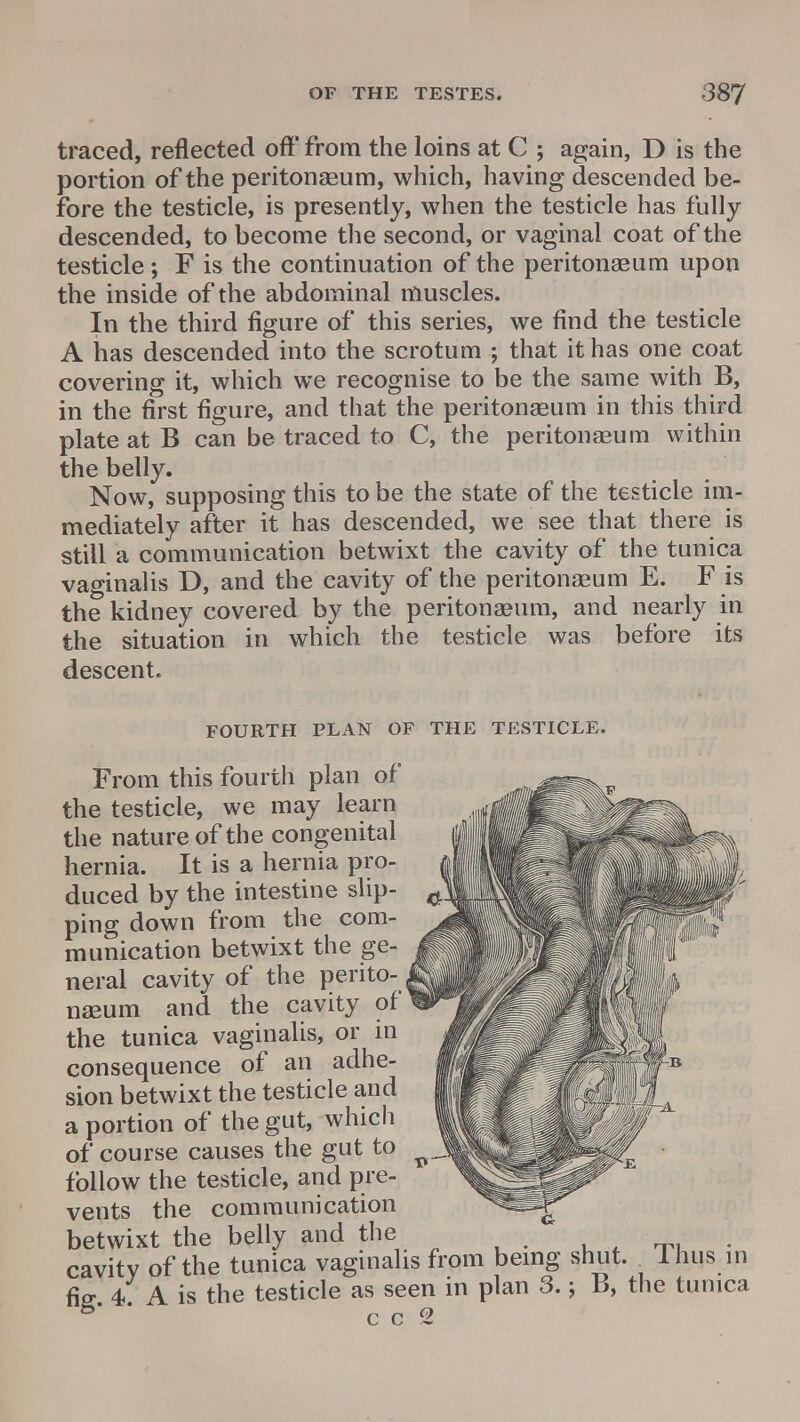 traced, reflected off from the loins at C ; again, D is the portion of the peritonaeum, which, having descended be- fore the testicle, is presently, when the testicle has fully descended, to become the second, or vaginal coat of the testicle; F is the continuation of the peritonaeum upon the inside of the abdominal muscles. In the third figure of this series, we find the testicle A has descended into the scrotum ; that it has one coat covering it, which we recognise to be the same with B, in the first figure, and that the peritonaeum in this third plate at B can be traced to C, the peritonaeum within the belly. Now, supposing this to be the state of the testicle im- mediately after it has descended, we see that there is still a communication betwixt the cavity of the tunica vaginalis D, and the cavity of the peritonaeum E. F is the kidney covered by the peritonaeum, and nearly in the situation in which the testicle was before its descent. FOURTH PLAN OF THE TESTICLE. From this fourth plan of the testicle, we may learn the nature of the congenital hernia. It is a hernia pro- duced by the intestine slip- ping down from the com- munication betwixt the ge- neral cavity of the perito- naeum and the cavity of the tunica vaginalis, or in consequence of an adhe- sion betwixt the testicle and a portion of the gut, which of course causes the gut to follow the testicle, and pre- vents the communication betwixt the belly and the cavity of the tunica vaginalis from being shut. Thus in fie 4 A is the testicle as seen in plan 3.; B, the tunica 5* c c 2