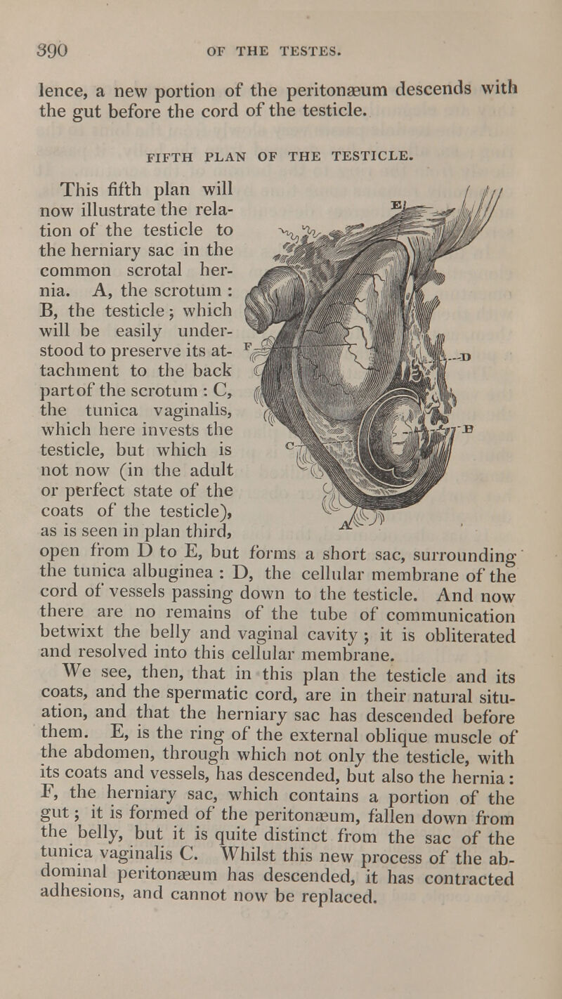 lence, a new portion of the peritonaeum descends with the gut before the cord of the testicle. FIFTH PLAN OF THE TESTICLE. This fifth plan will now illustrate the rela- tion of the testicle to the herniary sac in the common scrotal her- nia. A, the scrotum : B, the testicle j which will be easily under- stood to preserve its at- tachment to the back part of the scrotum : C, the tunica vaginalis, which here invests the testicle, but which is not now (in the adult or perfect state of the coats of the testicle), as is seen in plan third, open from D to E, but forms a short sac, surrounding the tunica albuginea : D, the cellular membrane of the cord of vessels passing down to the testicle. And now there are no remains of the tube of communication betwixt the belly and vaginal cavity ; it is obliterated and resolved into this cellular membrane. We see, then, that in this plan the testicle and its coats, and the spermatic cord, are in their natural situ- ation, and that the herniary sac has descended before them. E, is the ring of the external oblique muscle of the abdomen, through which not only the testicle, with its coats and vessels, has descended, but also the hernia: F, the herniary sac, which contains a portion of the gut; it is formed of the peritonaeum, fallen down from the belly, but it is quite distinct from the sac of the tunica vaginalis C. Whilst this new process of the ab- dominal peritonaeum has descended, it has contracted adhesions, and cannot now be replaced.