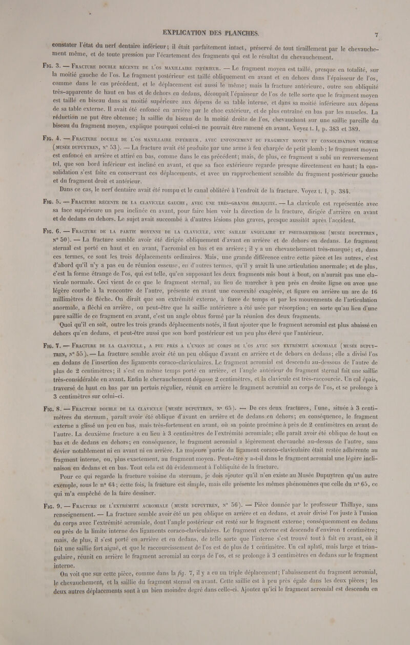 constater l'état du nerf dentaire inférieur; il était parfaitement intact, préservé de tout tiraillement par le chevauche- ment même, et de toute pression par l'écartement des fragments qui est le résultat du chevauchement. Fig. 3. — Fracture double récente de l'os maxillaire inférieur. — Le fragment moyen est taillé, presque en totalité, sur la moitié gauche de l'os. Le fragment postérieur est taillé obliquement en avant et en dehors dans l'épaisseur de l'os, comme dans le cas précédent, et le déplacement est aussi le même; mais la fracture antérieure, outre son obliquité très-apparente de haut en bas et de dehors en dedans, découpait l'épaisseur de l'os de telle sorte que le fragment moyen est taillé en biseau dans sa moitié supérieure aux dépens de sa table interne, et dans sa moitié inférieure aux dépens de sa table externe. Il avait été enfoncé en arrière par le choc extérieur, et de plus entraîné en bas par les muscles. La réduction ne put être obtenue; la saillie du biseau de la moitié droite de l'os, chevauchant sur une saillie pareille du biseau du fragment moyen, explique pourquoi celui-ci ne pouvait être ramené en avant. Voyez 1.1, p. 383 et 389. Fig. 4. — Fracture double de l'os maxillaire inférieur , avec enfoncement du fragment moyen et consolidation vicieuse (musée dupuytren, n° 53 ). — La fracture avait été produite par une arme à feu chargée de petit plomb ; le fragment moyen est enfoncé en arrière et attiré en bas, comme dans le cas précédent; mais, de plus, ce fragment a subi un renversement tel, que son bord inférieur est incliné en avant, et que sa face extérieure regarde presque directement en haut; la con- solidation s'est faite en conservant ces déplacements, et avec un rapprochement sensible du fragment postérieur gauche et du fragment droit et antérieur. Dans ce cas, le nerf dentaire avait été rompu et le canal oblitéré à l'endroit de la fracture. Voyez t. I, p. 384. Fig. 5.—Fracture récente de la clavicule gauche, avec une très-grande obliquité. — La clavicule est représentée avec sa face supérieure un peu inclinée en avant, pour faire bien voir la direction de la fracture, dirigée d'arrière en avant et de dedans en dehors. Le sujet avait succombé à d'autres lésions plus graves, presque aussitôt après l'accident. Fig. 6. — Fracture de la partie moyenne de la clavicule, avec saillie angulaire et pseudarthrose (musée dupuytren, n°50). — La fracture semble avoir été dirigée obliquement d'avant en arrière et de dehors en dedans. Le fragment sternal est porté en haut et en avant, l'acromial en bas et en arrière; il y a un chevauchement très-marqué; et, dans ces termes, ce sont les trois déplacements ordinaires. Mais, une grande différence entre cette pièce et les autres, c'est d'abord qu'il n'y a pas eu de réunion osseuse, en d'autres termes, qu'il y avait là une articulation anormale; et de plus, c'est la forme étrange de l'os, qui est telle, qu'en supposant les deux fragments mis bout à bout, on n'aurait pas une cla- vicule normale. Ceci vient de ce que le fragment sternal, au lieu de marcher à peu près en droite ligne ou avec une légère courbe à la rencontre de l'autre, présente en avant une convexité exagérée, et figure en arrière un arc de 16 millimètres de flèche. On dirait que son extrémité externe, à force de temps et par les mouvements de l'articulation anormale, a fléchi en arrière, ou peut-être que la saillie antérieure a été usée par résorption; en sorte qu'au lieu d'une pure saillie de ce fragment en avant, c'est un angle obtus formé par la réunion des deux fragments. Quoi qu'il en soit, outre les trois grands déplacements notés, il faut ajouter que le fragment acromial est plus abaissé en dehors qu'en dedans, et peut-être aussi que son bord postérieur est un peu plus élevé que l'antérieur. Fig. Y. — Fracture de la clavicule , a peu près a l'union du corps de l'os avec son extrémité acromiale (musée dupuy- tren, n° 55). — La fracture semble avoir été un peu oblique d'avant en arrière et de dehors en dedans; elle a divisé l'os en dedans de l'insertion des ligaments coraco-claviculaires. Le fragment acromial est descendu au-dessous de l'autre de plus de 2 centimètres; il s'est en même temps porté en arrière, et l'angle antérieur du fragment sternal fait une saillie très-considérable en avant. Enfin le chevauchement dépasse 2 centimètres, et la clavicule est très-raccourcie. Un cal épais, traversé de haut en bas par un pertuis régulier, réunit en arrière le fragment acromial au corps de l*os, et se prolonge à 3 centimètres sur celui-ci. Fig. 8. —Fracture double de la clavicule (musée dupuytren, n° 65). — De ces deux fractures, l'une, située à 3 centi- mètres du sternum, paraît avoir été oblique d'avant en arrière et de dedans en dehors; en conséquence, le fragment externe a glissé un peu en bas, mais très-fortement en avant, où sa pointe proémine à près de 2 centimètres en avant de l'autre. La deuxième fracture a eu lieu à 3 centimètres de l'extrémité acromiale; elle paraît avoir été oblique de haut en bas et de dedans en dehors; en conséquence, le fragment acromial a légèrement chevauché au-dessus de l'autre, sans dévier notablement ni en avant ni en arrière. La majeure partie du ligament coraco-claviculaire était restée adhérente au fragment interne, ou, plus exactement, au fragment moyen. Peut-être y a-t-il dans le fragment acromial une légère incli- naison en dedans et en bas. Tout cela est dû évidemment à l'obliquité de la fracture. Pour ce qui regarde la fracture voisine du sternum, je dois ajouter qu'il n'en existe au Musée Dupuytren qu'un autre exemple, sous le n° 64; cette fois, la fracture est simple, mais elle présente les mêmes phénomènes que celle du n 65, ce qui m'a empêché de la faire dessiner. Fig. 9. — Fracture de l'extrémité acromiale (musée dupuytren, n° 56). — Pièce donnée par le professeur Thillaye, sans renseignement. — La fracture semble avoir été un peu oblique en arrière et en dedans, et avoir divisé l'os juste à l'union du corps avec l'extrémité acromiale, dont l'angle postérieur est resté sur le fragment externe ; conséquemment en dedans ou près de la limite interne des ligaments coraco-claviculaires. Le fragment externe est descendu d'environ 1 centimètre; mais, de plus, il s'est porté en arrière et en dedans, de telle sorte que l'interne s'est trouvé tout à fait en avant, où il fait une saillie fort aiguë, et que le raccourcissement de l'os est de plus de 1 centimètre. Un cal aplati, mais large et trian- gulaire , réunit en arrière le fragment acromial au corps de l'os, et se prolonge à 3 centimètres en dedans sur le fragment interne. On voit que sur cette pièce, comme dans la fig. 7, il y a eu un triple déplacement; l'abaissement du fragment acromial, le chevauchement, et la saillie du fragment sternal en avant. Cette saillie est à peu près égale dans les deux pièces ; les deux autres déplacements sont à un bien moindre degré dans celle-ci. Ajoutez qu'ici le fragment acromial est descendu en