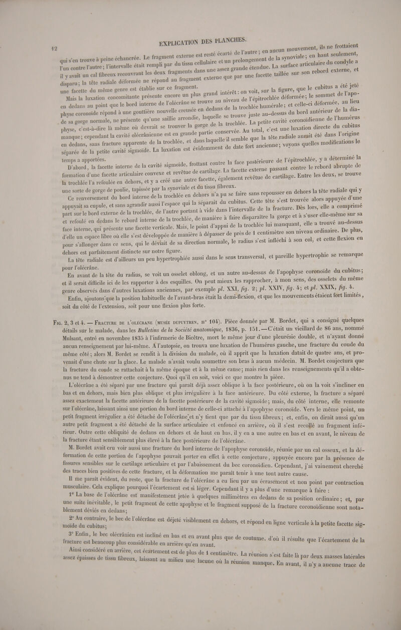 EXPLICATION mouvement, Us ne frottaient ■ v avait un cal fibreux recouvrant les deux fragments dans une a . taiUée sur son rebord externe, iLru ; la t«te radiale déformée ne répond au fragment externe que p Z facette du même genre est établie sur ce fragment. ^ ]& ^ que le cubltus a été jete Mais la luxation concomitante présente encore un plus P»* ^ rép trochlée déformée; le somme delapo eu dedans au point que le bord interne de l'olécrâne se ^™»7Z>Z humérale ; et celle-ci déformée au heu physe coronoide répond à une gouttière nouvelle creusée en dedans de h t o ^ ^ f „ d S/sa gorge normale, ne présente qu'une sailhe arrondie, JLa ite cavité cor0noidienne de l'hume us physe, c'est-à-dire là même où devrait se trouver ^ ^J^u J,, c>est u„e luxation directe du cubitus Lnque; cependant la cavité olécrânienne est en grande paitie couserve , ^ ^ dans r une sorte de gorge de poulie, tapissée par la synoviale et du.tissu; dehors u tête radiale qui y Ce renversement du bord interne delà trochlee en dehors n a pu se faire sans.repu» se ^ appuyait sa cupule, et sans agrandir aussi l'espace qui la séparait du cubitus. Cet e ™°^t0™\ » ^ imé part sur le bord externe de la trochlée, de l'autre portant à vide dans elle.même sur sa et refoulé en dedans le rebord interne de la trochlée, de mamere a fane disparaît™ la gorg et a s user face interne, qui présente une facette verticale. Mais, le point d'appui de la trochlee lui manquant, elle ^™ a^û Ï e un espace libre où elle s'est développée de manière à dépasser de près de 1 centime re son niveau <^-££% pour s'allonger dans ce sens, qui le déviait de sa direction normale, le radius s'est infléchi à son col, et cette flexion dehors est parfaitement distincte sur notre figure. «P wmamue La tête radiale est d'ailleurs un peu hypertrophiée aussi dans le sens transversal, et pareille hypertrophie se remarque Tn\tam de'la tête du radius, se voit un osselet oblong, et un autre au-dessus de l'apophyse coronoide du cubitus; et il serait difficile ici de les rapporter à des esquilles. On peut mieux les rapprocher, à mon sens, des osselets du même genre observés dans d'autres luxations anciennes, par exemple pl. XXI, fig. 2; pl. XXIV, fig. 4; et pl. XXIX, fig. 4. Enfin, ajoutons;que la position habituelle de l'avant-bras était la demi-flexion, et que les mouvements étaient fort limites, soit du côté de l'extension, soit pour une flexion plus forte. Fig. 2, 3 et 4. — Fracture de l'olécrane (musée dupuytren, n° 104). Pièce donnée par M. Bordet, qui a consigné quelques détails sur le malade, dans les Bulletins de la Société anatomique, 1836, p. 151.—C'était un vieillard de 86 ans, nommé Mulsant, entré en novembre 1835 à l'infirmerie de Bicêtre, mort le même jour d'une pleurésie double, et n'ayant donné aucun renseignement par lui-même. A l'autopsie, on trouva une luxation de l'humérus gauche, une fracture du coude du même côté ; alors M. Bordet se rendit à la division du malade, où il apprit que la luxation datait de quatre ans, et pro- venait d'une chute sur la glace. Le malade n'avait voulu soumettre son bras à aucun médecin. M. Bordet conjectura que la fracture du coude se rattachait à la même époque et à la même cause; mais rien dans les renseignements qu'il a obte- nus ne tend à démontrer cette conjecture. Quoi qu'il en soit, voici ce que montre la pièce. L'olécrâne a été séparé par une fracture qui paraît déjà assez oblique à la face postérieure, où on la voit s'incliner en bas et en dehors, mais bien plus oblique et plus irrégulière à la face antérieure. Du côté externe, la fracture a séparé assez exactement la facette antérieure delà facette postérieure de la cavité sigmoïde; mais, du côté interne, elle remonte sur l'olécrâne, laissant ainsi une portion du bord interne de celle-ci attaché à l'apophyse coronoide. Vers le même point, un petit fragment irrégulier a été détaché de l'olécrâne^et n'y tient que par du tissu fibreux; et, enfin, on dirait aussi qu'un autre petit fragment a été détaché de la surface articulaire et enfoncé en arrière, où il s'est recollé au fragment infé- rieur. Outre cette obliquité de dedans en dehors et de haut en bas, il y en a une autre en bas et en avant, le niveau de la fracture étant sensiblement plus élevé à la face postérieure de l'olécrâne. M. Bordet avait cru voir aussi une fracture du bord interne de l'apophyse coronoide, réunie par un cal osseux, et la dé- formation de cette portion de l'apophyse pouvait porter en effet à cette conjecture, appuyée encore par la présence de fissures sensibles sur le cartilage articulaire et par l'abaissement du bec coronoïdien. Cependant, j'ai vainement cherché des traces bien positives de cette fracture, et la déformation me paraît tenir à une tout autre cause. Il me paraît évident, du reste, que la fracture de l'olécrâne a eu lieu par un écrasement et non point par contraction musculaire. Cela explique pourquoi l'écartement est si léger. Cependant il y a plus d'une remarque à faire ■ 1» La base de l'olécrâne est manifestement jetée à quelques millimètres en dedans de sa position ordinaire; et, par une sut e inévitable le petit fragment de cette apophyse et le fragment supposé de la fracture coronoidienne sont no a- blement dévies en dedans; mo^s; 10 ^1,0léCrâne déj6té ViSib,ement  dehOTS> et ré*0nd en verticale à la petite facette sig- 3° Enfin le bec olécrânien est incliné en bas et en avant plus que de coutume, d'où il résulte que l'écartement de la fracture est beaucoup plus considérable en arrière qu'en avant. ecaitement ae ta Ainsi considéré en arrière, cet écartement est de nlus de 1 rentim«.fvo lo.- • » . * V „