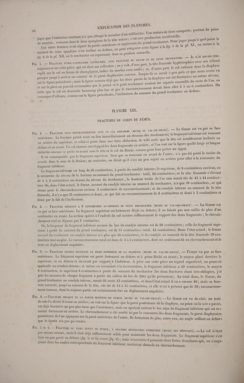 , Une «f* P*™' ',U 1>0mt ft. 2 .le la pl. XII, où le troehanter est représente dan, sa posit TR0CBANTER. - Je n'ai aucun ren- FlG. 5. - FkACTURB mXH.-CAPS^ CONSOLIDÉE, AVEC FRACTURE ™ serment sur cette pièce, qui est dans ma ce ection ; on yW une partA ^ ^ ^ ^ u diaphyse replié sur le col en forme de champignon, ce serait à peu près ce que nous avons vu presque jusqu'à arriver au contact de la paroi ^^^J^^iBt^ ont été fracturées au même niveau, sur la figure précédente; mais la figure montre deja que ^^A^J^ séparés ensemble du reste de 1 os, en et sur la pièce on pouvait reconnaître que e ^«^^SZ^m** devait bien aller à 5 ou 6 centimètres. On PLANCHE XIII. FRACTURES DU CORPS DU FÉMUR. F, 1. - Fracture avec u, cal difforme (musé, ™^ '^^2^2 antérieure. La fracture paraît avoir eu lieu immédiatement au-dessous d s troehanter .Qclinée ea en arrière du supérieur, et celui-ci porté dans une forte abduction, de tele sort que te ™* dedans et en avant. Un cal énorme enveloppait les deux fragments en arrière, et on voit sur la hgure quelle g stalactite osseuse se porte en avant sous la tête et le col du fémur, comme pour leur ^ W- H es. remarquable que le fragment supérieur, bien que se trouvant en avant de 1 autre, n a pas ete porte le moins du flexion; au contraire, on dirait qu'il s'est un peu rejeté en arrière pour aller ala rencontre du ^agLInl^é'rieur est long de 36 centimètres, à partir du condyle interne ; le supérieur, de 8 centimètres environ, en le mesurant du niveau de la fracture au sommet du grand troehanter : total, 42 centimètres ; et la tete fémorale s élevant de 1 à 2 centimètres au-dessus du niveau du troehanter, la hauteur totale de l'os sain aurait été de 43 à 44 centimè- tres Or dans l'état actuel, le fémur, mesuré du condyle interne au sommet du troehanter, n'a que 39 centimètres, ce qui donne pour le chevauchement environ 3 centimètres de raccourcissement; et du condyle interne au sommet de la tete fémorale, il n'y a que 37 centimètres et demi, ce qui fait un raccourcissement de 2 centimètres et demi à 3 centimètres et demi par le fait de l'inclinaison. Fig. 2. — Fracture siégeant a 6 centimètres au-dessous du petit trochanter (musée du val-de-grace). — Le fémur est vu par sa face antérieure. Le fragment supérieur est fortement dévié en dehors; il ne faisait pas une saillie de plus d'un centimètre en avant. La section opérée à l'endroit du cal montre suffisamment le rapport des deux fragments ; le chevau- chement réel ne dépasse pas 1 centimètre. Or, la longueur du fragment inférieur mesuré du bas du condyle interne est de 28 centimètres ; celle du fragment supé- rieur, à partir du sommet du grand troehanter, est de 14 centimètres : total, 42 centimètres. Dans l'état actuel, le fémur mesuré du trochanter au condyle interne n'a plus que 40 centimètres, et du condyle au sommet de la tête fémorale 39 cen- timètres tout au plus. Le raccourcissement total est donc de 3 à 4 centimètres, dont un seulement dû au chevauchement et le reste au déplacement angulaire. Fig. 3. — Fracture double occupant le tiers supérieur de la diaphyse (musée du val-de-grace). —Fémur vu par sa face antérieure. Le fragment supérieur est porté fortement en dehors et à peine fléchi en avant ; le moyen placé derrière le supérieur, et en dehors et en avant par rapport à l'inférieur. A jeter sur cette pièce un regard superficiel, on pourrait applaudir au résultat obtenu ; et même en recourant à la mensuration, le fragment inférieur a 29 centimètres, le moyen 6 centimètres, le supérieur 8 centimètres à partir du sommet du trochanter (les deux fractures étant très-obliques, j'ai pris les mesures de chaque fragment à partir du milieu du bec de flûte qu'ils présentent). Au total donc, le fémur, du grand trochanter au condyle interne, aurait dû avoir 43 centimètres, et dans l'état actuel il en a encore 40 ; mais sa hau- teur normale, jusqu'au sommet de la tête, eût été de 44 à 45 centimètres, et elle n'est à présent que de 38 ; raccourcisse- ment énorme, dont la majeure partie est certainement due au déplacement angulaire. Fig. 4.-Fracture oblique de la partie moyenne du fémur (musée du val-de-grace).-Le fémur est vu de côté; un trait de scie l'a divisé d'avant en arrière; on voit sur la figure que la paroi postérieure de la diaphyse, au point où la scie a passé, est deja fracturée un peu plus haut que l'antérieure, mais on aperçoit surtout le bec aigu du fragment inférieur qui est re- monte fortement en arrière. Le chevauchement a été arrêté ici par la rencontre des deux fragments, la paroi diaphysaire postérieure de 1 un appuyant sur la paroi antérieure de l'autre. Ils formaient de plus, entre eux, un angle saillant en dehors que le dessin n a pas pu rendre. Fig. 5 et G.-Fracture du tiers moyen du fémur, a grandes dentelures engrenées (musée des hôpitaux).-Le col n'était pas encore osseux, ma, U était déjà suffisamment solide pour maintenir les deux fragments. iLe fragment supérieur s'est en ,n peu porte en dehors (fig 5) et en avant (fig. 6) ; mais néanmoins il présente deux fortes dentelures qui en enga- geant dans les angles correspondants du fragment inférieur, mettaient obstacle au chevauchement