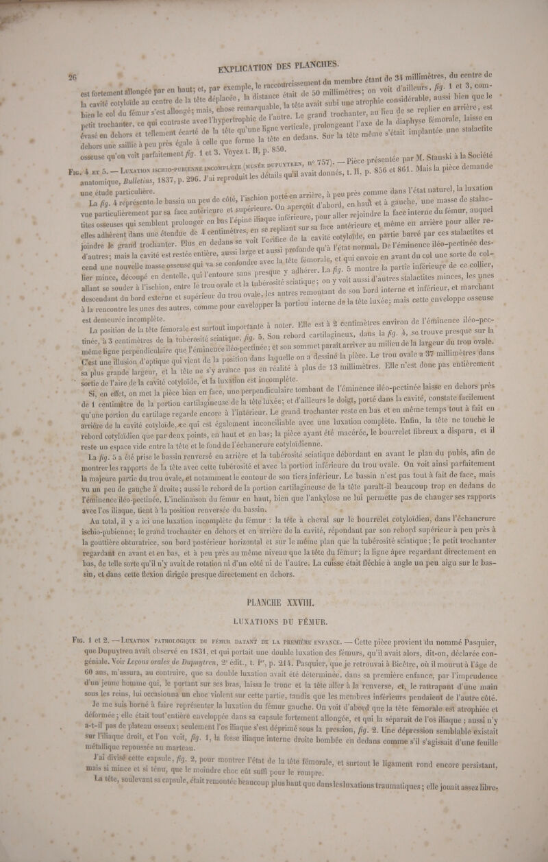 2f> j k„„ àtunt de 34 millimètres, du centre de * ^ «ongée par en haut; et, par * ? ? . fS^loîdeS centre de la «été déplacée, la distance a de o ^ b e Se o col du fémur s'est allongé; mais, chose remarquab ta a ^ ^ ^ p t «rochanter, ce qui contraste avec l'hypertroph.e de 1.*^«V^ raxe de la diaphyse fémorale, In. se en Lé en dehors et tellement écarté de la tête qu'une: H ne « l «*P *^ ^ ^ ^ implant6e une stalactite dehors une saillie à peu près égale à celle que forme laMtête «. osseusequonvoitparfaitement/ïj.lctS^oyezt. , p. • _ pièce présentée par M. Stanski à la Société * —- -™ fet-sïW 1 p856 et 861-Mais la pièce dcmandc anatomique, Bulletins, 18.37, p. 2Ub. J ai îepiuu une étude particulière. , „. .. n .| en arrière a peu près comme dans l'état naturel, la luxation La fr. 4 représente le bassin un peu de côte, 1 ^T^^^ \n hau\ et à gauche, une masse de stalac- vue particulièrement par sa face antérieure et ^^S^vonr all r rejoindre la faceinterne du fémur, auquel tites osseuses qui semblent prolonger en bas l'epme ^JjJ^^ antérieure et même en arrière pour aller ré- elles adhèrent dans une étendue de k centimètres, en se ebansur ^ ^ ^ ^ et joindre le grand trochanter. Plus en dedans se voit lontiçe rétat normal. De l'éminence iléo-pectinée des- d'autres; mais la cavité est restée entière, aussi large et aussi pio «rq ^ ^ ^ ^ ^ ^ ^ ^ d& ^ cend une nouvelle masse osseuse qui va se confondre avec > g montre ]a rtie inférieure de ce collier, lier mince, découpé en dentelle, qui l'entoure sans presque y ann . ' Jq id,autresstalactites minces, les unes allant se souder | l'ischion, entre le ^^^^oZlZo, bord interne et inférieur, et marchant est demeurée incomplète. centimètres environ de l'éminence iléo-pec- La ç*. * h ^^-.-Sjn calit «s I» * » <™ve près,. „ !a  snrtip de l'aire de la cavité cotvloïde, et la luxation est incomplète. Si en Ï « met la pièibien'en face, une perpendiculaire tombant de l'éminence iléo-pectinee laisse en; deborspres de 1 centimèlre de la portion cartilagineuse de la tête luxée; et d'ailleurs le doigt, porte dans la cavité, constate ac, lement qu'une portion du cartilage regarde encore à l'intérieur. Le grand trochanter reste en bas et en même temps tout a fait en arrière de la cavité colyloïde,*e qui est également inconciliable avec une luxation complète. Enfin, la tete ne touche le rebord cotyloïdien que par deux points, en haut et en bas; la pièce ayant été macérée, le bourrelet fibreux a disparu, et il reste un espace vide entre la tête et le fond de l'échancrurc cotyloïdienne. La fig. 5 a été prise le bassin renversé en arrière et la tubérosité sciatique débordant en avant le plan du pubis, afin de montrer les rapports de la tête avec cette tubérosité et avec la portion* inférieure du trou ovale. On voit ainsi parfaitement la majeure partie du trou ovale, et notamment le contour de son tiers inférieur. Le bassin n'est pas tout à fait de face, mais vu un peu de gauche à droite; aussi le rebord de la portion cartilagineuse de la tête paraît-il beaucoup trop en dedans de l'éminence ileo-pectinée. L'inclinaison du fémur en haut, bien que l'ankylose ne lui permette pas de changer ses rapports avec l'os iliaque, tient à la position renversée du bassin. Au total, il y a ici une luxation incomplète du fémur : la tête à cheval sur le bourrelet cotyloïdien, dans l'échancrurc ischio-pubienne; le grand trochanter en dehors et en arrière de la cavité, répondant par son rebord supérieur à peu près à la gouttière obturatrice, son bord postérieur horizontal et sur le même plan que la tubérosité sciatique ; le petit trochanter regardant en avant et en bas, et à peu près au même niveau que la tête du fémur; la ligne âpre regardant directement en bas, de telle sorte qu'il n'y avait de rotation ni d'un côté ni de l'autre. La cuisse était fléchie à angle un peu aigu sur le bas- sin, et dans cette flexion dirigée presque directement en dehors. PLANCHE XXVIII. LUXATIONS DU FÉMUR. Fig. 1 et 2.—Luxation pathologique dd fémur datant de la première enfance. — Cette pièce provient du nommé Pasquier, que Dupuytren avait observé en 1831, et qui portait une double luxation des fémurs, qu'il avait alors, dit-on, déclarée con- géniale. Voir lepons orales de Dupuylren, 2e édit., t. I, p. 214. Pasquier, que je retrouvai à Bicêtre, où il mourut à l'âge de 60 ans, m'assura, au contraire, que sa double luxation avait été déterminée, dans sa première enfance, par l'imprudence d'un jeune homme qui, le portant sur ses bras, laissa le tronc et la tête aller à la renverse, et, le rattrapant d'une main sous les reins, lui occasionna un choc violent sur cette partie, tandis que les membres inférieurs pendaient de l'autre côté. Je me suis borné à faire représenter la luxation du fémur gauche. On voit d'abord que la tête fémorale est atrophiée et déformée ; elle était toufentière enveloppée dans sa capsule fortement allongée, et qui la séparait de l'os iliaque ; aussi n'y a-t-,1 pas de plateau osseux; seulement ïos iliaque s'est déprimé sous la pression, fig. 2. Une dépression semblable existait sur 1,haque droit, et 1 on voit, fig. i, la fosse iliaque interne droite bombée en dedans comme s'il s'agissait d'une feuille métallique repoussee au marteau. J'ai divisé cette capsule, fig 2, pour montrer l'état de la tête fémorale, et surtout le ligament rond encore persistant mais s. mmee et s, tenu, que le moindre choc eût suffi pour le rompre persistant, La ,è,e,soulevantsa capsule, était remontée beaucoup plus haut que danslcsluxationstraumatiques; elle jouait assez 1^