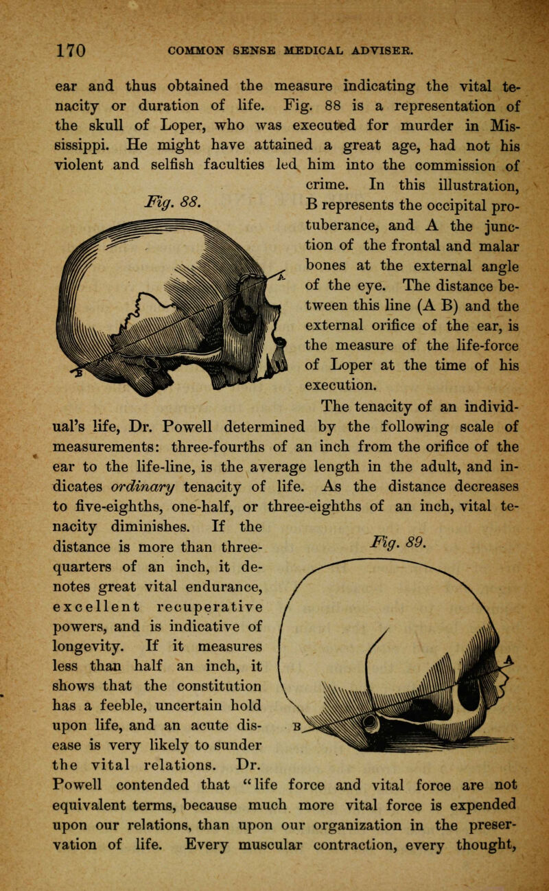 ear and thus obtained the measure indicating the vital te- nacity or duration of life. Fig. 88 is a representation of the skull of Loper, who was executed for murder in Mis- sissippi. He might have attained a great age, had not his violent and selfish faculties led him into the commission of crime. In this illustration, Fig. 88. B represents the occipital pro- tuberance, and A the junc- tion of the frontal and malar bones at the external angle of the eye. The distance be- tween this line (A B) and the external orifice of the ear, is the measure of the life-force of Loper at the time of his execution. The tenacity of an individ- ual's life, Dr. Powell determined by the following scale of measurements: three-fourths of an inch from the orifice of the ear to the life-line, is the average length in the adult, and in- dicates ordinary tenacity of life. As the distance decreases to five-eighths, one-half, or three-eighths of an inch, vital te- nacity diminishes. If the distance is more than three- *l9' ™* quarters of an inch, it de- notes great vital endurance, excellent recuperative powers, and is indicative of longevity. If it measures less than half an inch, it shows that the constitution has a feeble, uncertain hold upon life, and an acute dis- ease is very likely to sunder the vital relations. Dr. Powell contended that  life force and vital force are not equivalent terms, because much more vital force is expended upon our relations, than upon our organization in the preser- vation of life. Every muscular contraction, every thought,