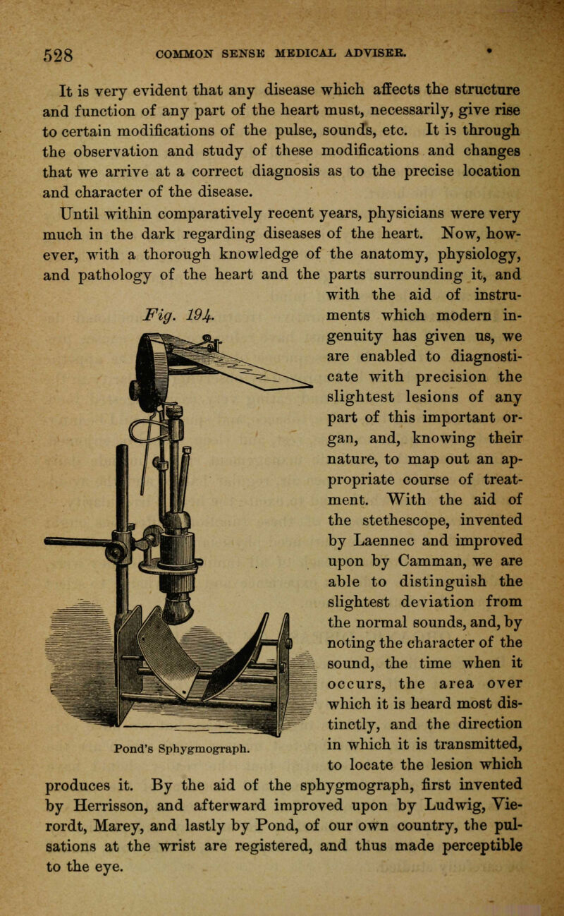 It is very evident that any disease which affects the structure and function of any part of the heart must, necessarily, give rise to certain modifications of the pulse, sounds, etc. It is through the observation and study of these modifications and changes that we arrive at a correct diagnosis as to the precise location and character of the disease. Until within comparatively recent years, physicians were very much in the dark regarding diseases of the heart. Now, how- ever, with a thorough knowledge of the anatomy, physiology, and pathology of the heart and the parts surrounding it, and with the aid of instru- Fig. 194-. ments which modern in- genuity has given us, we are enabled to diagnosti- cate with precision the slightest lesions of any part of this important or- gan, and, knowing their nature, to map out an ap- propriate course of treat- ment. With the aid of the stethescope, invented by Laennec and improved upon by Camman, we are able to distinguish the slightest deviation from the normal sounds, and, by noting the character of the l sound, the time when it occurs, the area over which it is heard most dis- tinctly, and the direction in which it is transmitted, to locate the lesion which produces it. By the aid of the sphygmograph, first invented by Herrisson, and afterward improved upon by Ludwig, Vie- rordt, Marey, and lastly by Pond, of our own country, the pul- sations at the wrist are registered, and thus made perceptible to the eye. Pond's Sphygmograph.