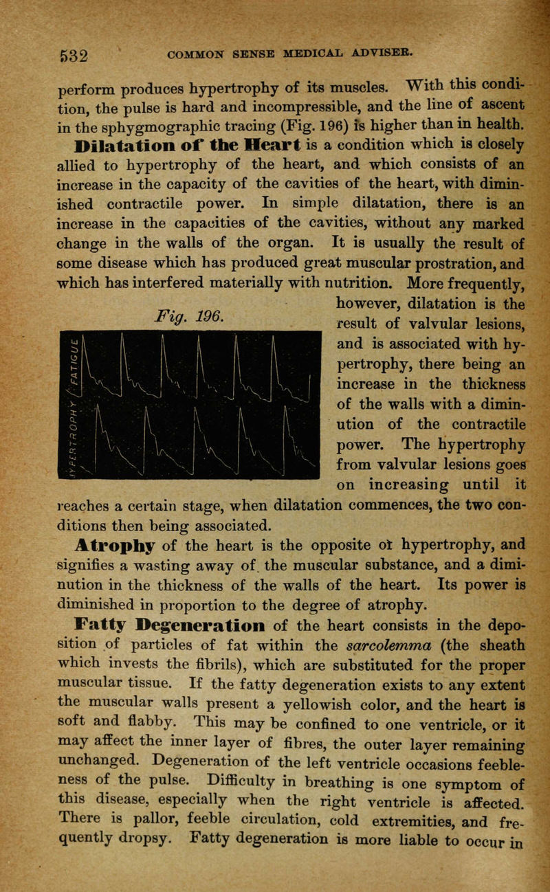 perform produces hypertrophy of its muscles. With this condi- tion, the pulse is hard and incompressible, and the line of ascent in the sphygmographic tracing (Fig. 196) is higher than in health. Dilatation of the Heart is a condition which is closely allied to hypertrophy of the heart, and which consists of an increase in the capacity of the cavities of the heart, with dimin- ished contractile power. In simple dilatation, there is an increase in the capacities of the cavities, without any marked change in the walls of the organ. It is usually the result of some disease which has produced great muscular prostration, and which has interfered materially with nutrition. More frequently, however, dilatation is the &' J result of valvular lesions, and is associated with hy- pertrophy, there being an increase in the thickness of the walls with a dimin- ution of the contractile power. The hypertrophy from valvular lesions goes on increasing until it i-eaches a certain stage, when dilatation commences, the two con- ditions then being associated. Atrophy of the heart is the opposite oi hypertrophy, and signifies a wasting away of. the muscular substance, and a dimi- nution in the thickness of the walls of the heart. Its power is diminished in proportion to the degree of atrophy. Fatty Degeneration of the heart consists in the depo- sition of particles of fat within the sarcolemma (the sheath which invests the fibrils), which are substituted for the proper muscular tissue. If the fatty degeneration exists to any extent the muscular walls present a yellowish color, and the heart is soft and flabby. This may be confined to one ventricle, or it may affect the inner layer of fibres, the outer layer remaining unchanged. Degeneration of the left ventricle occasions feeble- ness of the pulse. Difficulty in breathing is one symptom of this disease, especially when the right ventricle is affected. There is pallor, feeble circulation, cold extremities, and fre- quently dropsy. Fatty degeneration is more liable to occur in