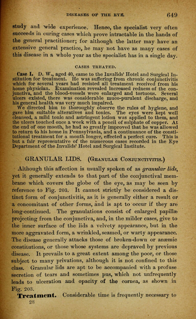 study and >vide experience. Hence, the specialist very often succeeds in curing cases which prove intractable in the hands of the general practitioner; for although the latter may have an extensive general practice, he may not have as many cases of this disease in a whole year as the specialist has in a single day. CASES TREATED. Case I. D. W., aged 40, came to the Invalids' Hotel and Surgical In- stitution for treatment. He was suffering from chronic conjunctivitis which for several years had resisted all treatment received from his home physician. Examination revealed increased redness of the con- junctiva, and the blood-vessels were enlarged and tortuous. Several ulcers existed, there was considerable muco-purulent discharge, and his general health was very much impaired. We directed him to thoroughly observe the rules of hygiene, and gave him suitable alteratives and tonics. The eyes were kept well cleansed, a mild tonic and astringent lotion was applied to them, and the ulcers touched once a week with a pencil of sulphate of copper. At the end of one month, he had so greatly improved that he was allowed to return to his home in Pennsylvania, and a continuance of the consti- tutional treatment for a month longer, effected a perfect cure. This is but a fair representative of the numerous cases recorded in the Eye Department of the Invalids' Hotel and Surgical Institute. GRANULAR LIDS. (Granular Conjunctivitis.) • Although this affection is usually spoken of as granular lids, yet it generally extends to that part of the conjunctival mem- brane which covers the globe of the eye, as may be seen by reference to Fig. 203. It cannot strictly be considered a dis- tinct form of conjunctivitis, as it is generally either a result or a concomitant of other forms, and is apt to occur if they are long-continued. The granulations consist of enlarged papilla? projecting from the conjunctiva, and, in the milder cases, give to the inner surface of the lids a velvety appearance, but in the more aggravated form, a wrinkled, seamed, or warty appearance. The disease generally attacks those of broken-down or ansemic constitutions, or those whose systems are depraved by previous disease. It prevails to a great extent among the poor, or those subject to many privations, although it is not confined to this class. Granular lids are apt to be accompanied with a profuse secretion of tears and sometimes pus, which not unfrequently leads to ulceration and opacity of the cornea, as shown in Fig. 203. Xreatment. Considerable time is frequently necessary to 28