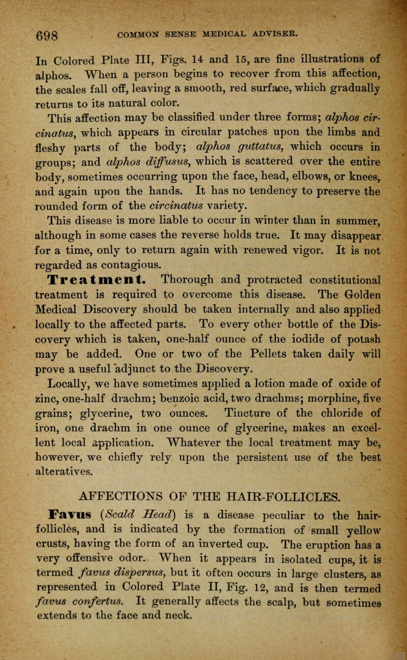 In Colored Plate III, Figs. 14 and 15, are fine illustrations of alphos. When a person begins to recover from this affection, the scales fall off, leaving a smooth, red surface, which gradually returns to its natural color. This affection may be classified under three forms; alphos cir- cinatus, which appears in circular patches upon the limbs and fleshy parts of the body; alphos guttatus, which occurs in groups; and alphos diffusus, which is scattered over the entire body, sometimes occurring upon the face, head, elbows, or knees, and again upon the hands. It has no tendency to preserve the rounded form of the circinatus variety. This disease is more liable to occur in winter than in summer, although in some cases the reverse holds true. It may disappear for a time, only to return again with renewed vigor. It is not regarded as contagious. Treatment. Thorough and protracted constitutional treatment is required to overcome this disease. The Golden Medical Discovery should be taken internally and also applied locally to the affected parts. To every other bottle of the Dis- covery which is taken, one-half ounce of the iodide of potash may be added. One or two of the Pellets taken daily will prove a useful adjunct to the Discovery. Locally, we have sometimes applied a lotion made of oxide of zinc, one-half drachm; benzoic acid, two drachms; morphine, five grains; glycerine, two ounces. Tincture of the chloride of iron, one drachm in one ounce of glycerine, makes an excel- lent local application. Whatever the local treatment may be, however, we chiefly rely upon the persistent use of the best alteratives. AFFECTIONS OF THE HAIR-FOLLICLES. Favus {Scald Head) is a disease peculiar to the hair- follicles, and is indicated by the formation of small yellow crusts, having the form of an inverted cup. The eruption has a very offensive odor. When it appears in isolated cups, it is termed favus dispersus, but it often occurs in large clusters, as represented in Colored Plate II, Fig. 12, and is then termed favus confertus. It generally affects the scalp, but sometimes extends to the face and neck.
