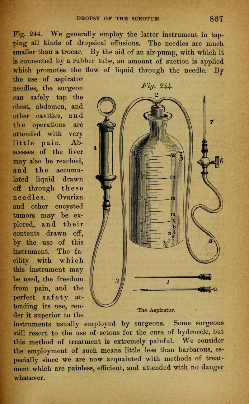 Fig. m- 2 Fig. 244. We generally employ the latter instrument in tap- ping all kinds of dropsical effusions. The needles are much smaller than a trocar. By the aid of an air-pump, with which it is connected by a rubber tube, an amount of suction is applied which promotes the flow of liquid through the needle. By the use of aspirator needles, the surgeon can safely tap the chest, abdomen, and other cavities, and the operations are attended with very little pain. Ab- scesses of the liver may also be reached, and the accumu- lated liquid drawn off through these needles. Ovarian and other encysted tumors may be ex- plored, and their contents drawn off, by the use of this instrument. The fa- cility with which this instrument may be used, the freedom from pain, and the perfect safety at- tending its use, ren- der it superior to the instruments usually employed by surgeons. Some surgeons still resort to the use of setons for the cure of hydrocele, but this method of treatment is extremely painful. We consider the employment of such means little less than barbarous, es- pecially since we are now acquainted with methods of treat- ment which are painless, efficient, and attended with no danger whatever. The Aspirator.