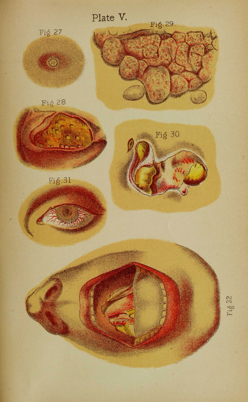 Plate V. F16.29 Fi£ 27 CV3 en -■-» Ph