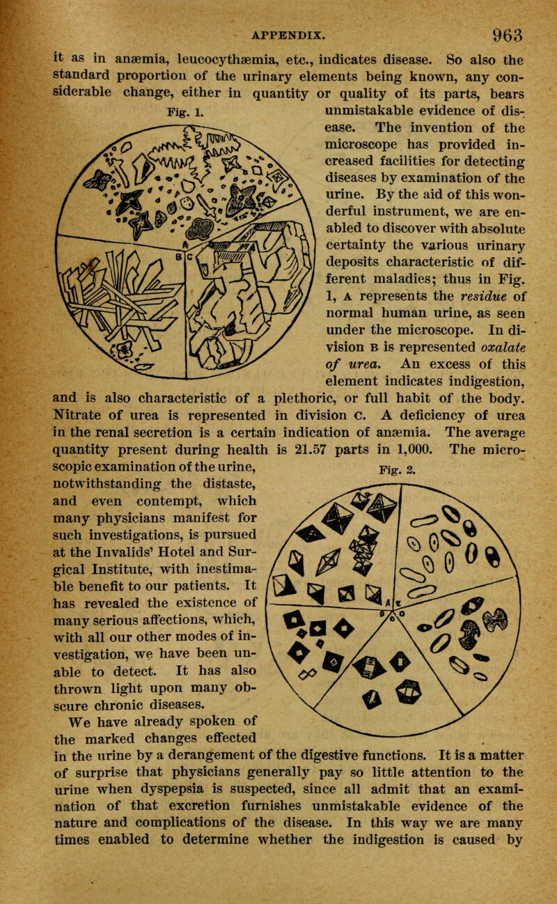 it as in anaemia, leucocythaemia, etc., indicates disease. So also the standard proportion of the urinary elements being known, any con- siderable change, either in quantity or quality of its parts, bears Fig. l. unmistakable evidence of dis- ease. The invention of the microscope has provided in- creased facilities for detecting diseases by examination of the urine. By the aid of this won- derful instrument, we are en- abled to discover with absolute certainty the various urinary deposits characteristic of dif- ferent maladies; thus in Fig. 1, A represents the residue of normal human urine, as seen under the microscope. In di- vision b is represented oxalate of urea. An excess of this element indicates indigestion, and is also characteristic of a plethoric, or full habit of the body. Nitrate of urea is represented in division c. A deficiency of urea in the renal secretion is a certain indication of anaemia. The average quantity present during health is 21.57 parts in 1,000. The micro- scopic examination of the urine, -pig. 2. notwithstanding the distaste, and even contempt, which many physicians manifest for such investigations, is pursued at the Invalids' Hotel and Sur- gical Institute, with inestima- ble benefit to our patients. It has revealed the existence of many serious affections, which, with all our other modes of in- vestigation, we have been un- able to detect. It has also thrown light upon many ob- scure chronic diseases. We have already spoken of the marked changes effected in the urine by a derangement of the digestive functions. It is a matter of surprise that physicians generally pay so little attention to the urine when dyspepsia is suspected, since all admit that an exami- nation of that excretion furnishes unmistakable evidence of the nature and complications of the disease. In this way we are many times enabled to determine whether the indigestion is caused by