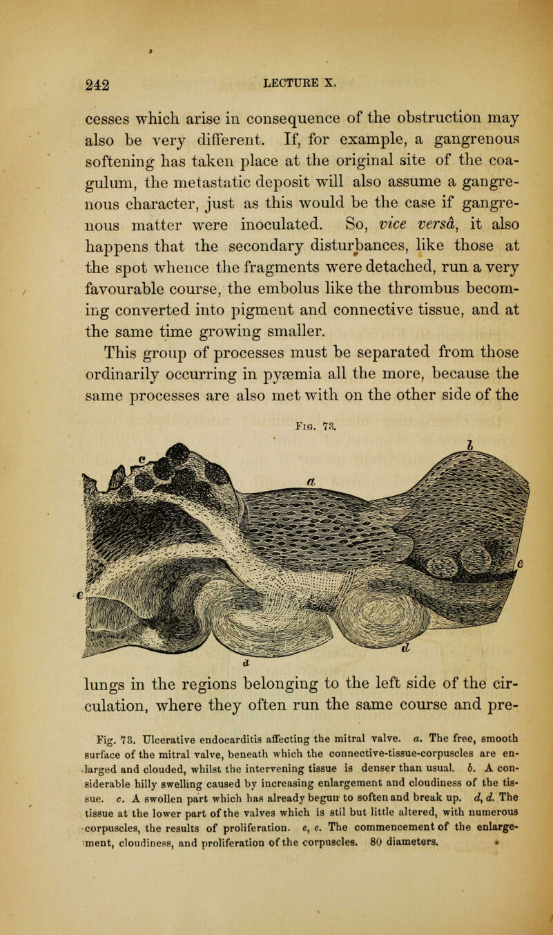 cesses which arise in consequence of the obstruction may also be very different. If, for example, a gangrenous softening has taken place at the original site of the coa- gulum, the metastatic deposit will also assume a gangre- nous character, just as this would be the case if gangre- nous matter were inoculated. So, vice versa, it also happens that the secondary disturbances, like those at the spot whence the fragments were detached, run a very favourable course, the embolus like the thrombus becom- ing converted into pigment and connective tissue, and at the same time growing smaller. This group of processes must be separated from those ordinarily occurring in pyaemia all the more, because the same processes are also met with on the other side of the Fig. 73. lungs in the regions belonging to the left side of the cir- culation, where they often run the same course and pre- Fig. 73. Ulcerative endocarditis affecting the mitral valve, a. The free, smooth surface of the mitral valve, beneath which the connective-tissue-corpuscles are en- larged and clouded, whilst the intervening tissue is denser than usual, b. A con- siderable hilly swelling caused by increasing enlargement and cloudiness of the tis- sue, c. A swollen part which has already begun to soften and break up. d} d. The tissue at the lower part of the valves which is stil but little altered, with numerous corpuscles, the results of proliferation, e, e. The commencement of the enlarge- ment, cloudiness, and proliferation of the corpuscles. 80 diameters. •