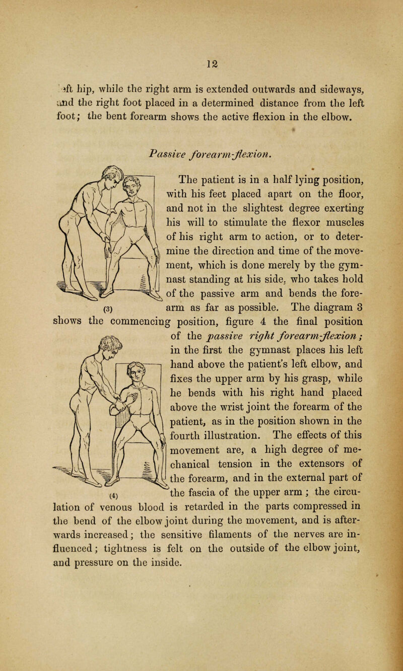 ift hip, while the right arm is extended outwards and sideways, und the right foot placed in a determined distance from the left foot; the bent forearm shows the active flexion in the elbow. Passive forearm-flexion. The patient is in a half lying position, with his feet placed apart on the floor, and not in the slightest degree exerting his will to stimulate the flexor muscles of his right arm to action, or to deter- mine the direction and time of the move- ment, which is done merely by the gym- nast standing at his side, who takes hold of the passive arm and bends the fore- arm as far as possible. The diagram 3 shows the commencing position, figure 4 the final position of the passive right forearm flexion; in the first the gymnast places his left hand above the patient's left elbow, and fixes the upper arm by his grasp, while he bends with his right hand placed above the wrist joint the forearm of the patient, as in the position shown in the fourth illustration. The effects of this movement are, a high degree of me- chanical tension in the extensors of the forearm, and in the external part of 'the fascia of the upper arm ; the circu- lation of venous blood is retarded in the parts compressed in the bend of the elbow joint during the movement, and is after- wards increased; the sensitive filaments of the nerves are in- fluenced; tightness is felt on the outside of the elbow joint, and pressure on the inside.