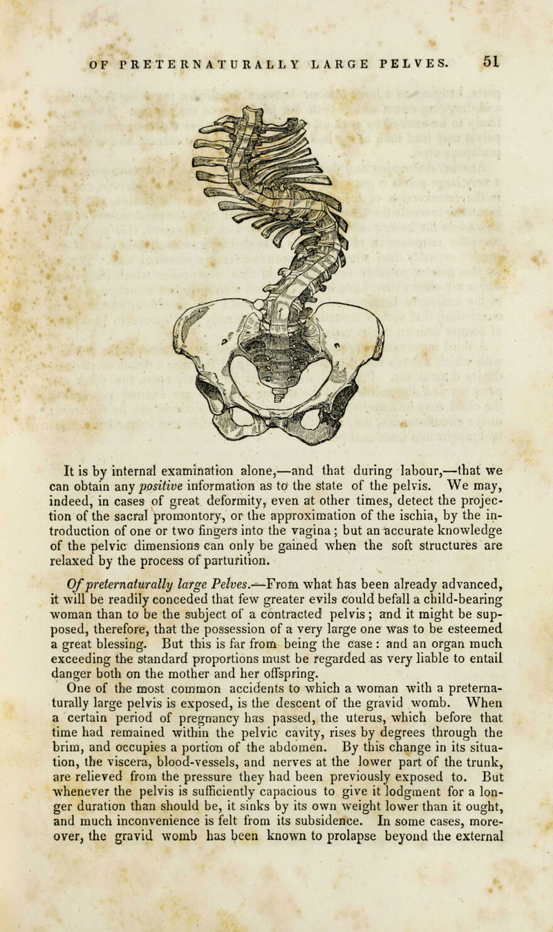 It is by internal examination alone,—and that during labour,—that we can obtain any positive information as to the state of the pelvis. We may, indeed, in cases of great deformity, even at other times, detect the projec- tion of the sacral promontory, or the approximation of the ischia, by the in- troduction of one or two fingers into the vagina; but an accurate knowledge of the pelvic dimensions can only be gained when the soft structures are relaxed by the process of parturition. Of preternaturally large Pelves.-^-From what has been already advanced, it will be readily conceded that few greater evils could befall a child-bearing woman than to be the subject of a contracted pelvis; and it might be sup- posed, therefore, that the possession of a very large one was to be esteemed a great blessing. But this is far from being the case : and an organ much exceeding the standard proportions must be regarded as very liable to entail danger both on the mother and her offspring. One of the most common accidents to which a woman with a preterna- turally large pelvis is exposed, is the descent of the gravid womb. When a certain period of pregnancy has passed, the uterus, which before that time had remained within the pelvic cavity, rises by degrees through the brim, and occupies a portion of the abdomen. By this change in its situa- tion, the viscera, blood-vessels, and nerves at the lower part of the trunk, are relieved from the pressure they had been previously exposed to. But whenever the pelvis is sufficiently capacious to give it lodgment for a lon- ger duration than should be, it sinks by its own weight lower than it ought, and much inconvenience is felt from its subsidence. In some cases, more- over, the gravid womb has been known to prolapse beyond the external