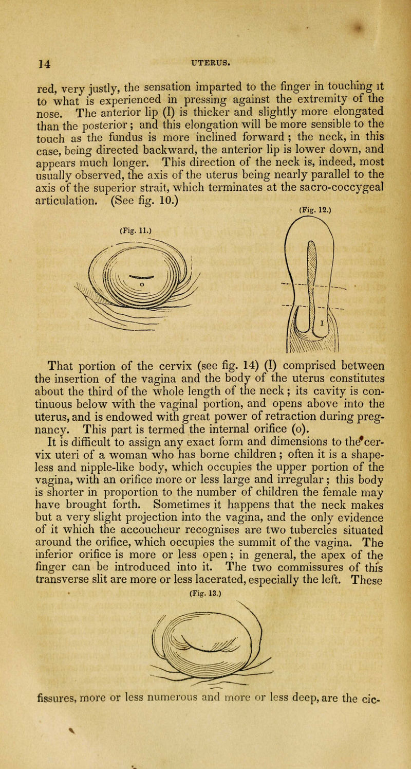 red, very justly, the sensation imparted to the finger in touching it to what is experienced in pressing against the extremity of the nose. The anterior lip (I) is thicker and slightly more elongated than the posterior; and this elongation will be more sensible to the touch as the fundus is more inclined forward; the neck, in this case, being directed backward, the anterior lip is lower down, and appears much longer. This direction of the neck is, indeed, most usually observed, the axis of the uterus being nearly parallel to the axis of the superior strait, which terminates at the sacro-coccygeal articulation. (See fig. 10.) (Fig. 12.) (Fig. 11.) That portion of the cervix (see fig. 14) (I) comprised between the insertion of the vagina and the body of the uterus constitutes about the third of the whole length of the neck; its cavity is con- tinuous below with the vaginal portion, and opens above into the uterus, and is endowed with great power of retraction during preg- nancy. This part is termed the internal orifice (o). It is difficult to assign any exact form and dimensions to the*cer- vix uteri of a woman who has borne children; often it is a shape- less and nipple-like body, which occupies the upper portion of the vagina, with an orifice more or less large and irregular; this body is shorter in proportion to the number of children the female may have brought forth. Sometimes it happens that the neck makes but a very slight projection into the vagina, and the only evidence of it which the accoucheur recognises are two tubercles situated around the orifice, which occupies the summit of the vagina. The inferior orifice is more or less open; in general, the apex of the finger can be introduced into it. The two commissures of this transverse slit are more or less lacerated, especially the left. These (Fig. 13.) fissures, more or less numerous and more or less deep, are the cic-