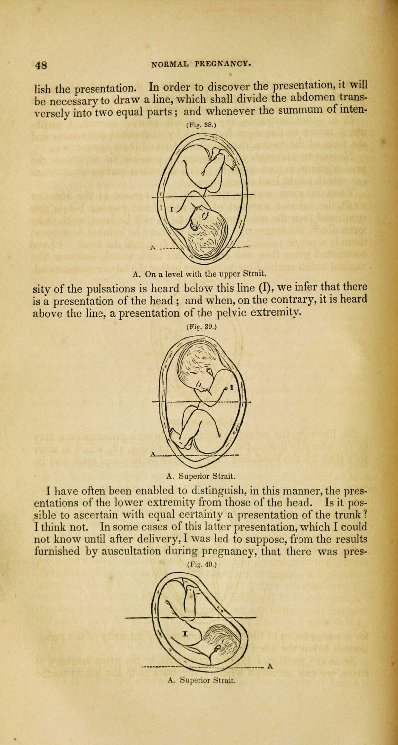 lish the presentation. In order to discover the presentation, it will be necessary to draw a line, which shall divide the abdomen trans- versely into two equal parts; and whenever the summum of inten- (Fig. 38.) A. On a level with the upper Strait. sity of the pulsations is heard below this line (I), we infer that there is a presentation of the head ; and when, on the contrary, it is heard above the line, a presentation of the pelvic extremity. (Fig. 39.) A. Superior Strait. I have often been enabled to distinguish, in this manner, the pres- entations of the lower extremity from those of the head. Is it pos- sible to ascertain with equal certainty a presentation of the trunk ? I think not. In some cases of this latter presentation, which I could not know until after delivery, I was led to suppose, from the results furnished by auscultation during pregnancy, that there was pres- (Fig. 40.) - A A. Superior Strait.