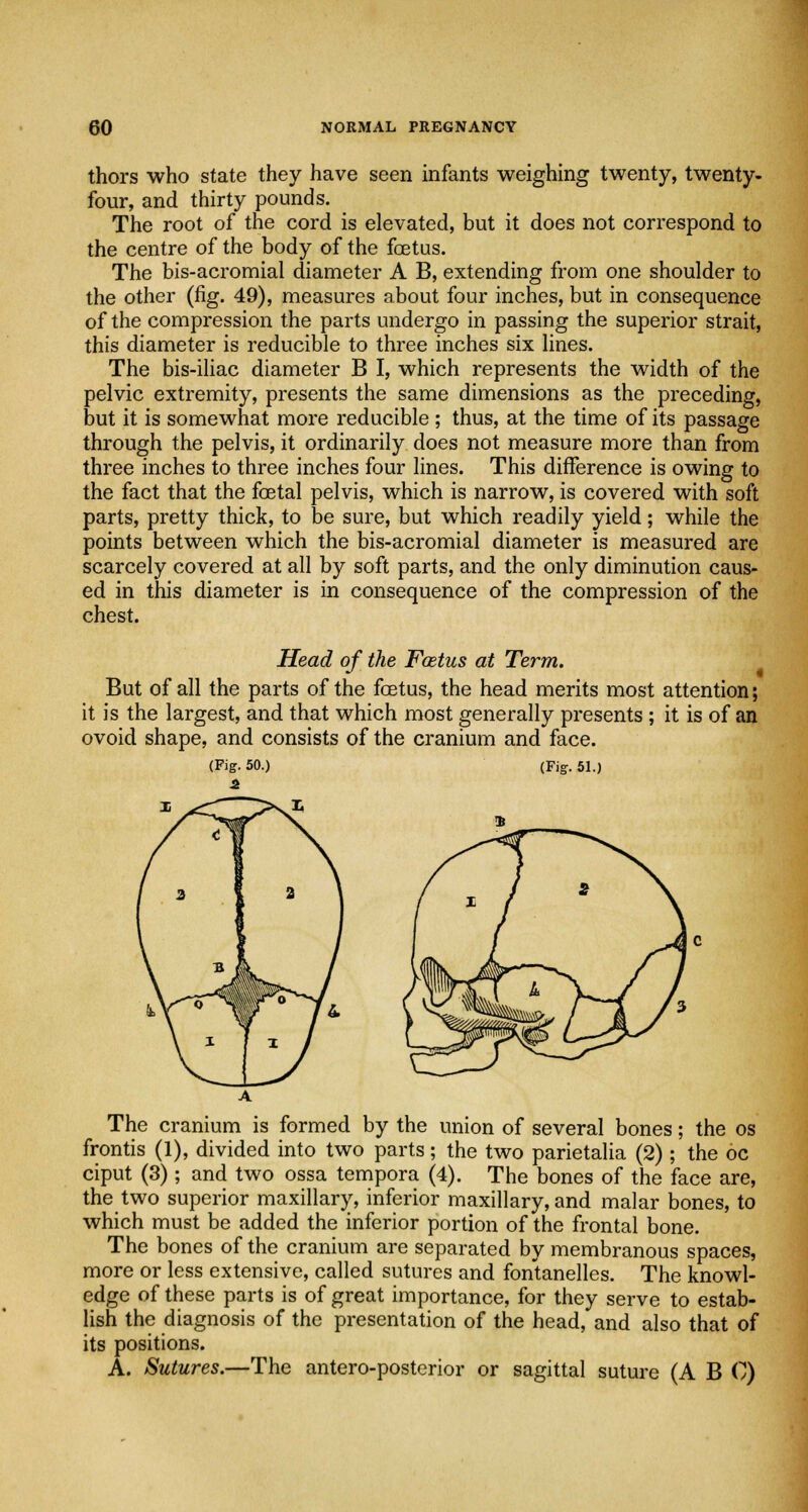 thors who state they have seen infants weighing twenty, twenty- four, and thirty pounds. The root of the cord is elevated, but it does not correspond to the centre of the body of the foetus. The bis-acromial diameter A B, extending from one shoulder to the other (fig. 49), measures about four inches, but in consequence of the compression the parts undergo in passing the superior strait, this diameter is reducible to three inches six lines. The bis-iliac diameter B I, which represents the width of the pelvic extremity, presents the same dimensions as the preceding, but it is somewhat more reducible ; thus, at the time of its passage through the pelvis, it ordinarily does not measure more than from three inches to three inches four lines. This difference is owing to the fact that the foetal pelvis, which is narrow, is covered with soft parts, pretty thick, to be sure, but which readily yield; while the points between which the bis-acromial diameter is measured are scarcely covered at all by soft parts, and the only diminution caus- ed in this diameter is in consequence of the compression of the chest. Head of the Foetus at Term. But of all the parts of the foetus, the head merits most attention; it is the largest, and that which most generally presents ; it is of an ovoid shape, and consists of the cranium and face. (Fig. 51.) The cranium is formed by the union of several bones; the os frontis (1), divided into two parts; the two parietalia (2) ; the oc ciput (3) ; and two ossa tempora (4). The bones of the face are, the two superior maxillary, inferior maxillary, and malar bones, to which must be added the inferior portion of the frontal bone. The bones of the cranium are separated by membranous spaces, more or less extensive, called sutures and fontanelles. The knowl- edge of these parts is of great importance, for they serve to estab- lish the diagnosis of the presentation of the head, and also that of its positions. A. Sutures.—The antero-posterior or sagittal suture (A B 0)