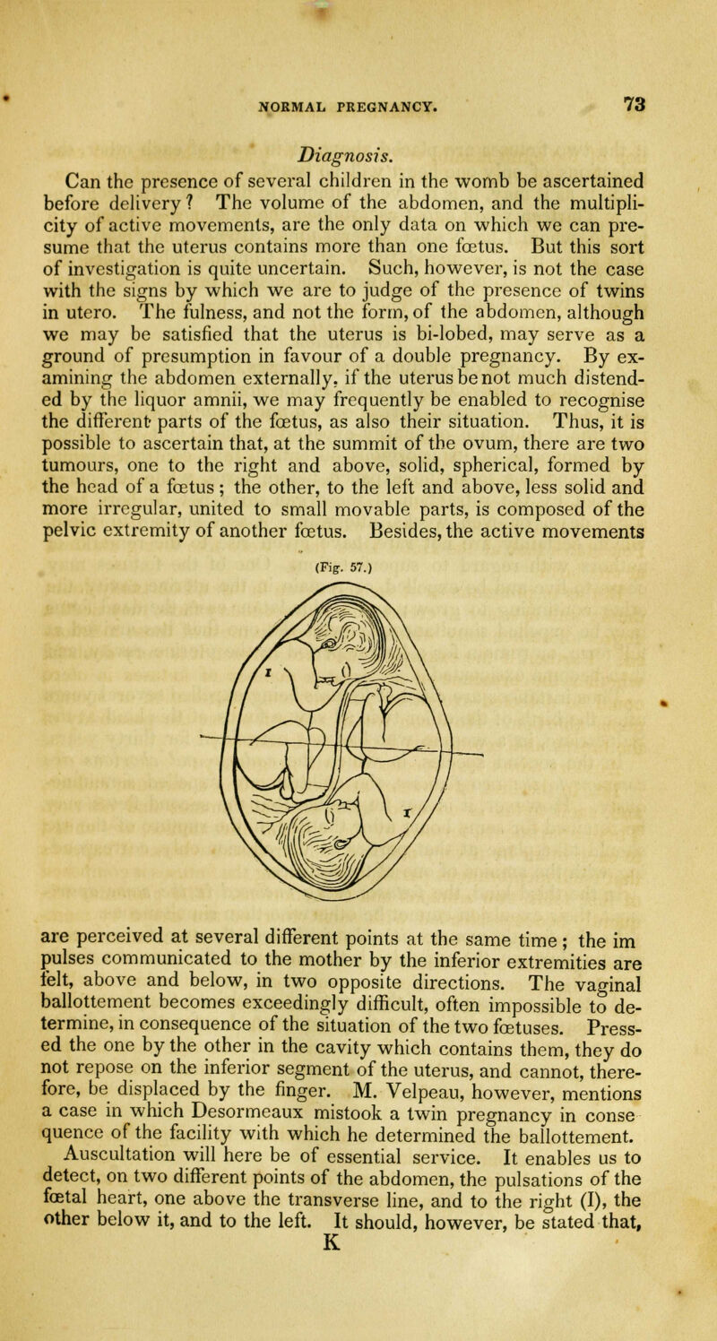 Diagnosis. Can the presence of several children in the womb be ascertained before delivery ? The volume of the abdomen, and the multipli- city of active movements, are the only data on which we can pre- sume that the uterus contains more than one foetus. But this sort of investigation is quite uncertain. Such, however, is not the case with the signs by which we are to judge of the presence of twins in utero. The fulness, and not the form, of the abdomen, although we may be satisfied that the uterus is bi-lobed, may serve as a ground of presumption in favour of a double pregnancy. By ex- amining the abdomen externally, if the uterus be not much distend- ed by the liquor amnii, we may frequently be enabled to recognise the different parts of the foetus, as also their situation. Thus, it is possible to ascertain that, at the summit of the ovum, there are two tumours, one to the right and above, solid, spherical, formed by the head of a foetus; the other, to the left and above, less solid and more irregular, united to small movable parts, is composed of the pelvic extremity of another foetus. Besides, the active movements (Fig. 57.) are perceived at several different points at the same time; the im pulses communicated to the mother by the inferior extremities are felt, above and below, in two opposite directions. The vaginal ballottement becomes exceedingly difficult, often impossible to de- termine, in consequence of the situation of the two foetuses. Press- ed the one by the other in the cavity which contains them, they do not repose on the inferior segment of the uterus, and cannot, there- fore, be displaced by the finger. M. Velpeau, however, mentions a case in which Desormeaux mistook a twin pregnancy in conse quence of the facility with which he determined the ballottement. Auscultation will here be of essential service. It enables us to detect, on two different points of the abdomen, the pulsations of the foetal heart, one above the transverse line, and to the right (I), the other below it, and to the left. It should, however, be stated that, K