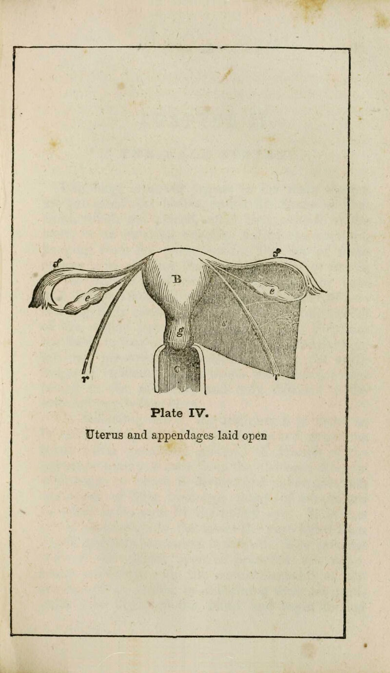 Plate IV. Uterus and appendages laid open