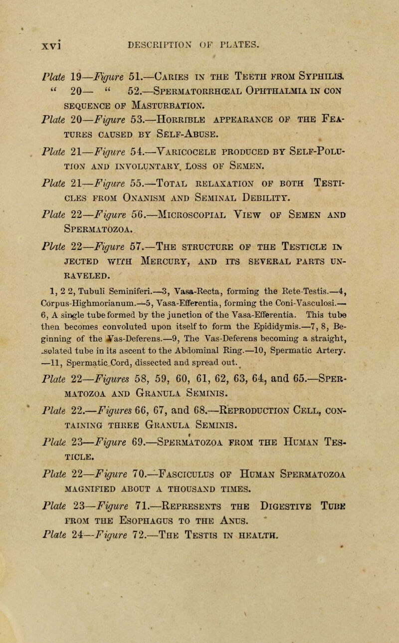 Plate 19—Figure 51.—Caries in the Teeth from Syphilis.  20—  52.—Spermatorrhceal Ophthalmia in con sequence of masturbation. Plate 2d—Figure 53.—Horrible appearance of the Fea- tures caused by Self-Abuse. Plate 21—Figure 54.—Varicocele produced by Self-Polu- TION AND INVOLUNTARY LOSS OF SEMEN. Plate 21—Figure 55.—Total relaxation of both Testi- cles from Onanism and Seminal Debility. Plate 22—Figure 56.—Microscopial View of Semen and Spermatozoa. Plate 22—Figure 57.—The structure of the Testicle in jected with Mercury, and its several parts un- raveled. 1, 2 2, Tubuli Seminiferi.—3, Vasa-Recta, forming the Rete-Testis.—4, Corpus-Highmorianum.—5, Vasa-Efferentia, forming the Coni-Vasculosi.— 6, A single tube formed by the junction of the Vasa-Efferentia. This tube then becomes convoluted upon itself to form the Epididymis.—7, 8, Be- ginning of the J^as-Deferens.—9, The Vas-Deferens becoming a straight, .selated tube in its ascent to the Abdominal Ring.—10, Spermatic Artery. —11, Spermatic Cord, dissected and spread out.^ Plate 22—Figures 58, 59, 60, 61, 62, 63, 64, and 65.—Sper- matozoa and Granula Seminis. Plate 22.—Figures 66, 67, and 68.—Reproduction Cell, con- taining three Granula Seminis. Plate 23—Figure 69.—Spermatozoa from the Human Tes- ticle. Plate 22—Figure 70.—Fasciculus of Human Spermatozoa magnified about a thousand times. Plate 23—Figure 71.—Represents the Digestive Tube prom the Esophagus to the Anus. Plate 24—Figure 72.—The Testis in health.