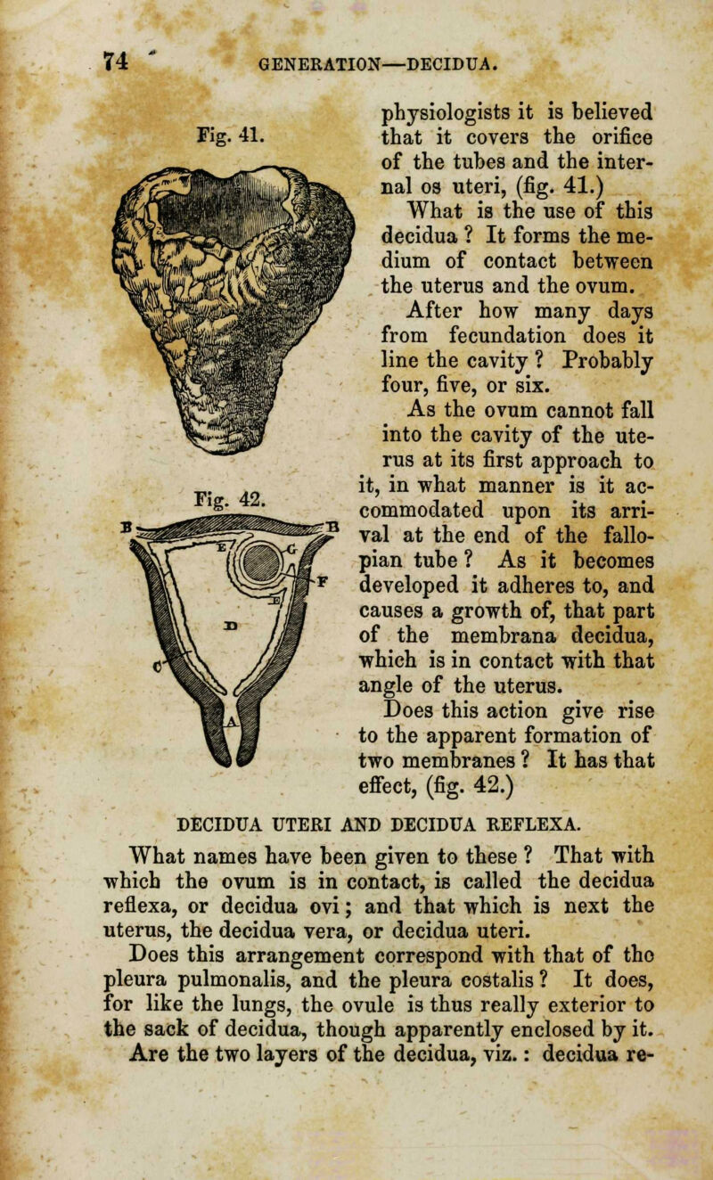 Fig. 41. Fig. 42. physiologists it is believed that it covers the orifice of the tubes and the inter- nal os uteri, (fig. 41.) What is the use of this decidua ? It forms the me- dium of contact between the uterus and the ovum. After how many days from fecundation does it line the cavity ? Probably four, five, or six. As the ovum cannot fall into the cavity of the ute- rus at its first approach to it, in what manner is it ac- commodated upon its arri- val at the end of the fallo- pian tube ? As it becomes developed it adheres to, and causes a growth of, that part of the membrana decidua, which is in contact with that angle of the uterus. Does this action give rise to the apparent formation of two membranes ? It has that effect, (fig. 42.) DECIDUA UTERI AND DECIDUA REFLEXA. What names have been given to these ? That with which the ovum is in contact, is called the decidua reflexa, or decidua ovi; and that which is next the uterus, the decidua vera, or decidua uteri. Does this arrangement correspond with that of tho pleura pulmonalis, and the pleura costalis ? It does, for like the lungs, the ovule is thus really exterior to the sack of decidua, though apparently enclosed by it. Are the two layers of the decidua, viz.: decidua re-