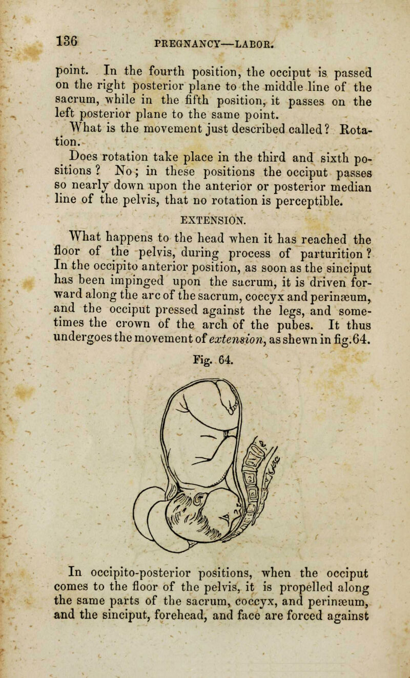 point. In the fourth position, the occiput is passed on the right posterior plane to the middle line of the sacrum, while in the fifth position, it passes on the left posterior plane to the same point. What is the movement just described called? Rota- tion. Does rotation take place in the third and sixth po- sitions ? No; in these positions the occiput passes so nearly down upon the anterior or posterior median line of the pelvis, that no rotation is perceptible. EXTENSION. What happens to the head when it has reached the floor of the pelvis, during process of parturition ? In the occipito anterior position, as soon as the sinciput has been impinged upon the sacrum, it is driven for- ward along the arc of the sacrum, coccyx and perinasum, and the occiput pressed against the legs, and some- times the crown of the arch of the pubes. It thus undergoes the movement of extension, as shewn in fig. 64. Fig. 64. In occipito-posterior positions, when the occiput comes to the floor of the pelvis, it is propelled along the same parts of the sacrum, coccyx, and perinseum, and the sinciput, forehead, and face are forced against