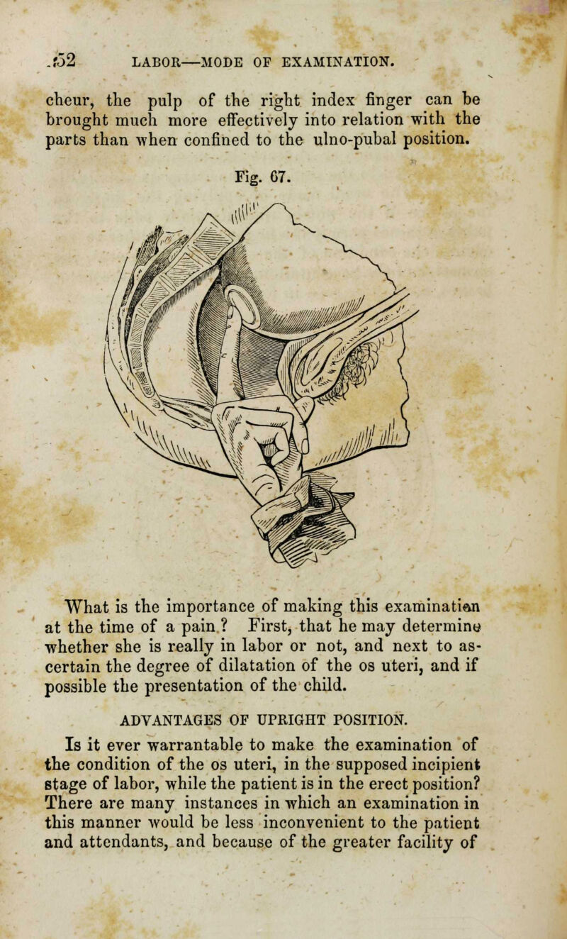 cheur, the pulp of the right index finger can be brought much more effectively into relation with the parts than when confined to the ulno-pubal position. Fig. 67. What is the importance of making this examinati&n at the time of a pain ? First, that he may determine •whether she is really in labor or not, and next to as- certain the degree of dilatation of the os uteri, and if possible the presentation of the child. ADVANTAGES OF UPRIGHT POSITION. Is it ever warrantable to make the examination of the condition of the os uteri, in the supposed incipient stage of labor, while the patient is in the erect position? There are many instances in which an examination in this manner Avould be less inconvenient to the patient and attendants, and because of the greater facility of