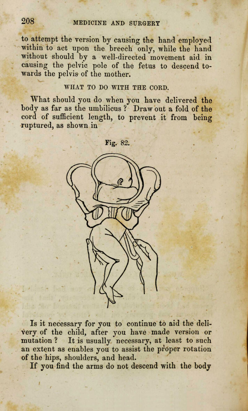 to attempt the version by causing the hand employed within to act upon the breech only, -while the hand without should by a well-directed movement aid in causing the pelvic pole of the fetus to descend to- wards the pelvis of the mother. WHAT TO DO WITH THE CORD. What should you do when you have delivered the body as far as the umbilicus ? Draw out a fold of the cord of sufficient length, to prevent it from being ruptured, as shown in Fig. 82. Is it necessary for you to continue to aid the deli- very of the child, after you have made version or mutation ? It is usually, necessary, at least to such an extent as enables you to assist the proper rotation of the hips, shoulders, and head. If you find the arms do not descend with the body