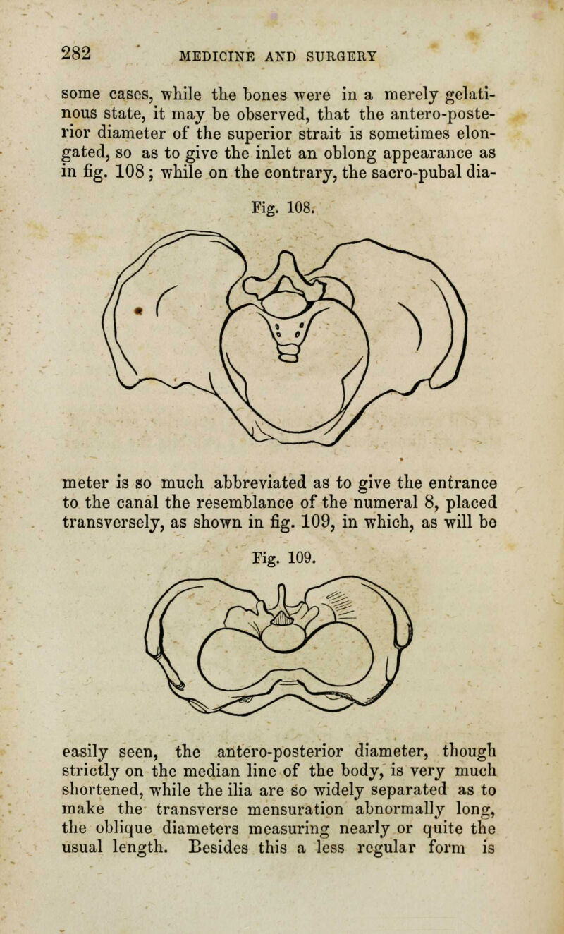 some cases, while the hones were in a merely gelati- nous state, it may be observed, that the anteroposte- rior diameter of the superior strait is sometimes elon- gated, so as to give the inlet an oblong appearance as in fig. 108; while on the contrary, the sacro-pubal dia- Fig. 108. meter is so much abbreviated as to give the entrance to the canal the resemblance of the numeral 8, placed transversely, as shown in fig. 109, in which, as will be easily seen, the antero-posterior diameter, though strictly on the median line of the body, is very much shortened, while the ilia are so widely separated as to make the transverse mensuration abnormally long, the oblique diameters measuring nearly or quite the usual length. Besides this a less regular form is