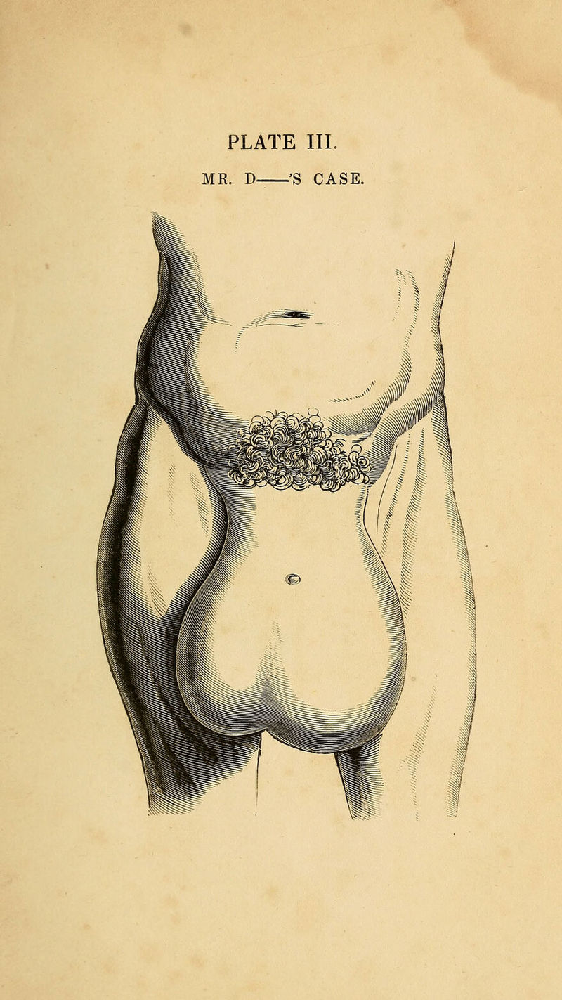 MR. D 'S CASE.
