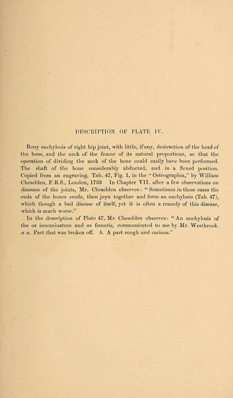 DESCRIPTION OF PLATE IT. Bony anchylosis of right hip joint, with little, if any, destruction of the head of the hone, and the neck of the femur of its natural proportions, so that the operation of dividing the neck of the bone could easily have been performed. The shaft of the bone considerably abducted, and in a flexed position. Copied from an engraving, Tab. 47, Fig. 1, in the  Osteographia, by William Cheselden, E.E..S., London, 1733 In Chapter VII, after a few observations on diseases of the joints, Mr. Cheselden observes:  Sometimes in these cases the ends of the bones erode, then joyn together and form an anchylosis (Tab. 47), which though a bad disease of itself, yet it is often a remedy of this disease, which is much worse. In the description of Plate 47, Mr. Cheselden observes:  An anchylosis of the os innominatum and os femoris, communicated to me by Mr. Westbrook. a a. Part that was broken off. b. A part rough and carious.