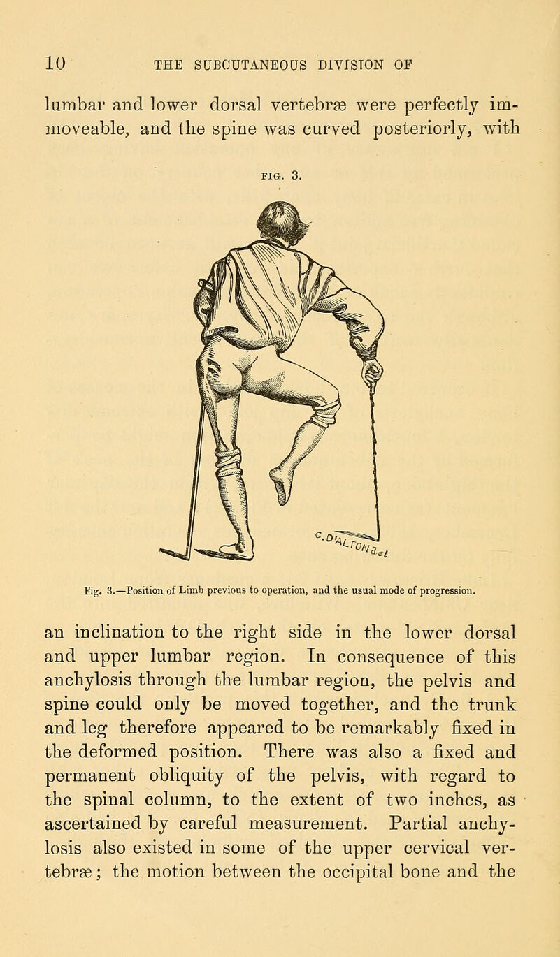 lumbar and lower dorsal vertebrae were perfectly im- moveable, and the spine was curved posteriorly, with FIG. 3. Tig. 3.—Position of Limb previous to operation, and the usual mode of progression. an inclination to the right side in the lower dorsal and upper lumbar region. In consequence of this anchylosis through the lumbar region, the pelvis and spine could only be moved together, and the trunk and leg therefore appeared to be remarkably fixed in the deformed position. There was also a fixed and permanent obliquity of the pelvis, with regard to the spinal column, to the extent of two inches, as ascertained by careful measurement. Partial anchy- losis also existed in some of the upper cervical ver- tebras ; the motion between the occipital bone and the