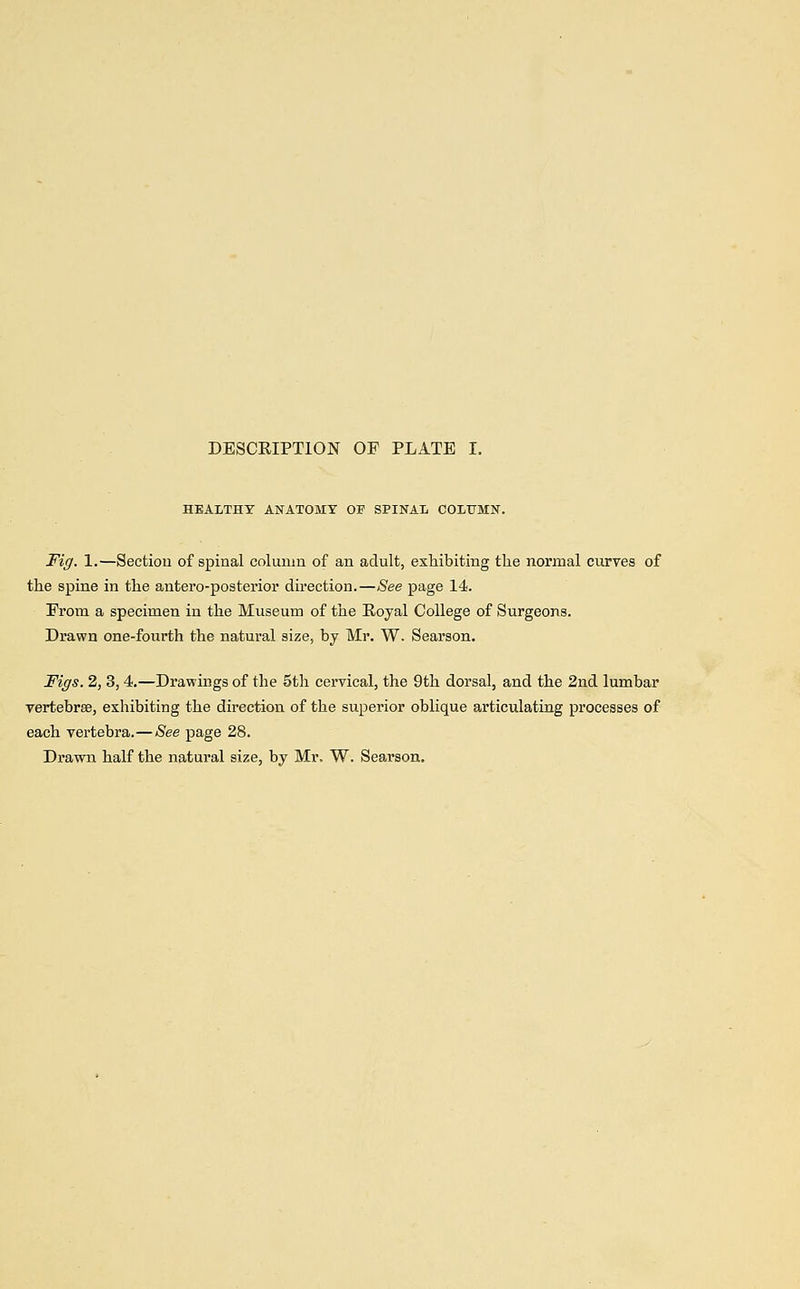HEALTHY ANATOMY OF SPINAL COLUMN. Fig. 1.—Section of spinal column of an adult, exhibiting the normal curves of the spine in the antero-posterior direction.—See page 14. From a specimen in the Museum of the Royal College of Surgeons. Drawn one-fourth the natural size, by Mr. W. Searson. Figs. 2, 3, 4.—Drawings of the 5th cervical, the 9th dorsal, and the 2nd lumbar vertebrae, exhibiting the direction of the superior oblique articulating processes of each vertebra.—See page 28. Drawn half the natural size, by Mr. W. Searson.