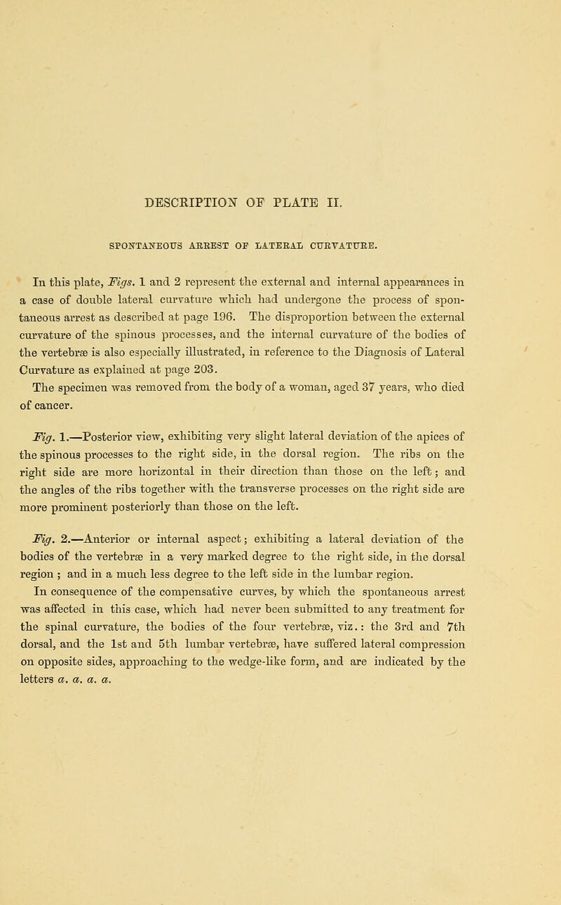 SPONTANEOUS ARREST OF LATERAL CURVATURE. In this plate, Figs. 1 and 2 represent the external and internal appearances in a case of double lateral curvature which had undergone the process of spon- taneous arrest as described at page 196. The disproportion between the external curvature of the spinous processes, and the internal curvature of the bodies of the vertebrae is also especially illustrated, in reference to the Diagnosis of Lateral Curvature as explained at page 203. The specimen was removed from the body of a woman, aged 37 years, who died of cancer. Fig. 1.—Posterior view, exhibiting very slight lateral deviation of the apices of the spinous processes to the right side, in the dorsal region. The ribs on the right side are more horizontal in their direction than those on the left; and the angles of the ribs together with the transverse processes on the right side are more prominent posteriorly than those on the left. Fig. 2.—Anterior or internal aspect; exhibiting a lateral deviation of the bodies of the vertebrae in a very marked degree to the right side, in the dorsal region ; and in a much less degree to the left side in the lumbar region. In consequence of the compensative curves, by which the spontaneous arrest was affected in this case, which had never been submitted to any treatment for the spinal curvature, the bodies of the four vertebrae, viz.: the 3rd and 7th dorsal, and the 1st and 5th lumbar vertebrae, have suffered lateral compression on opposite sides, approaching to the wedge-like form, and are indicated by the letters a. a. a. a.