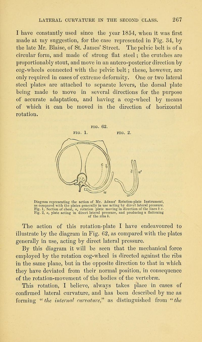 I have constantly used since the year 1854, when it was first made at my suggestion, for the case represented in Fig. 34, by the late Mr. Blaise, of St. James' Street. The pelvic belt is of a circular form, and made of strong flat steel; the crutches are proportionably stout, and move in an antero-posterior direction by cog-wheels connected with the pelvic belt; these, however, are only required in cases of extreme deformity. One or two lateral steel plates are attached to separate levers, the dorsal plate being made to move in several directions for the purpose of accurate adaptation, and having a cog-wheel by means of which it can be moved in the direction of horizontal rotation. FIG. 62. FIG. 1. FIG. 2. Diagram representing the action of Mr. Adams' Rotation-plate Instrument, as compared with tlie plates generally in use acting by direct lateral pressure. Fig. 1, Section of chest, a, rotation plate moving in direction of the lines b c. Tig. 2, a, plate acting in direct lateral pressure, and producing a flattening of the ribs b. The action of this rotation-plate I have endeavoured to illustrate by the diagram in Fig. 62, as compared with the plates generally in use, acting by direct lateral pressure. By this diagram it will be seen that the mechanical force employed by the rotation cog-wheel is directed against the ribs in the same plane, but in the opposite direction to that in which they have deviated from their normal position, in consequence of the rotation-movement of the bodies of the vertebrae. This rotation, I believe, always takes place in cases of confirmed lateral curvature, and has been described by me as forming  the internal curvature as distinguished from  the