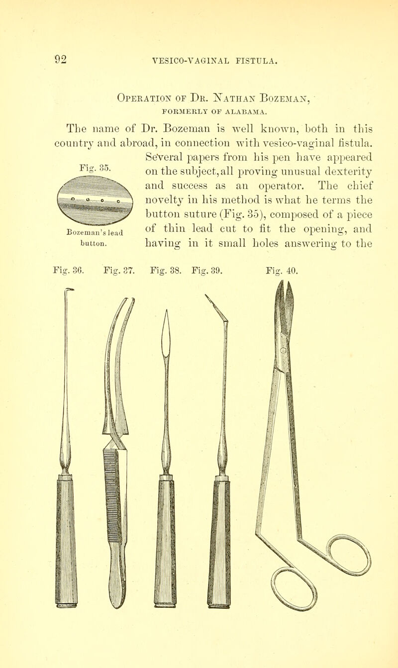 Operation of Dr. Nathan Bozeman, FORMERLY OF ALABAMA. The name of Dr. Bozeman is well known, both in this country and abroad, in connection with vesico-vaginal fistula. Several papers from his pen have appeared on the subject,all proving unusual dexterity and success as an operator. The chief novelty in his method is what he terms the button suture (Fig. 35), composed of a piece of thin lead cut to fit the opening, and button. bavins: in it small holes answering to the Fie;. 35. Fi°\ Fijy. 37. Fie. 38. Fie. 39. Fis:. 40.