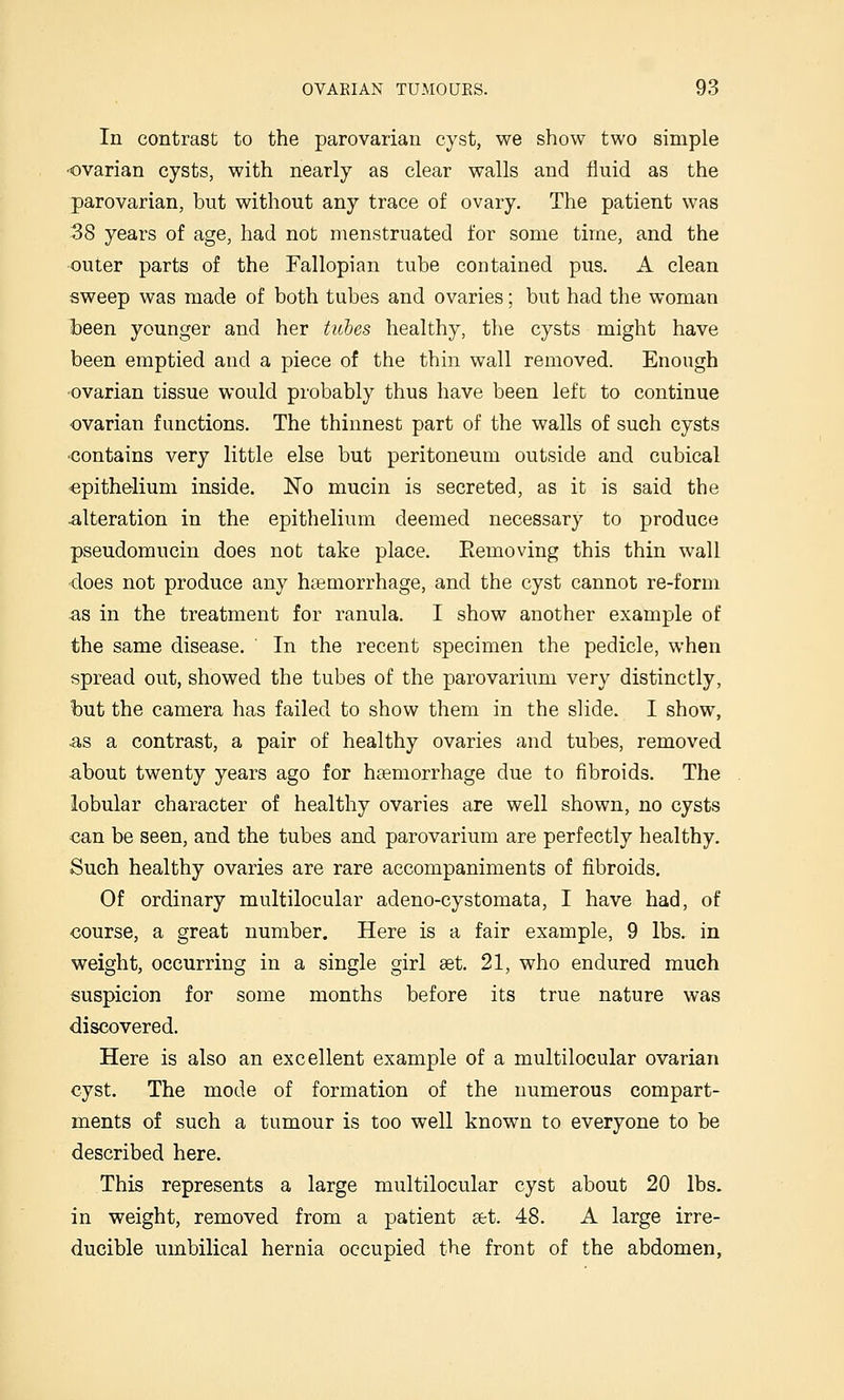 In contrast to the parovarian cyst, we show two simple •ovarian cysts, with nearly as clear walls and fluid as the parovarian, but without any trace of ovary. The patient was 38 years of age, had not menstruated for some time, and the •outer parts of the Fallopian tube contained pus. A clean sweep was made of both tubes and ovaries; but had the woman been younger and her tubes healthy, the cysts might have been emptied and a piece of the thin wall removed. Enough •ovarian tissue would probably thus have been left to continue ovarian functions. The thinnest part of the walls of such cysts ■contains very little else but peritoneum outside and cubical epithelium inside. No mucin is secreted, as it is said the alteration in the epithelium deemed necessary to produce pseudomucin does not take place. Eemoving this thin wall does not produce any haemorrhage, and the cyst cannot re-form as in the treatment for ranula. I show another example of the same disease. In the recent specimen the pedicle, when spread out, showed the tubes of the parovarium very distinctly, but the camera has failed to show them in the slide. I show, as a contrast, a pair of healthy ovaries and tubes, removed about twenty years ago for hemorrhage due to fibroids. The lobular character of healthy ovaries are well shown, no cysts €an be seen, and the tubes and parovarium are perfectly healthy. Such healthy ovaries are rare accompaniments of fibroids. Of ordinary multilocular adeno-cystomata, I have had, of course, a great number. Here is a fair example, 9 lbs. in weight, occurring in a single girl aet. 21, who endured much suspicion for some months before its true nature was discovered. Here is also an excellent example of a multilocular ovarian cyst. The mode of formation of the numerous compart- ments of such a tumour is too well known to everyone to be described here. This represents a large multilocular cyst about 20 lbs. in weight, removed from a patient set. 48. A large irre- ducible umbilical hernia occupied the front of the abdomen.
