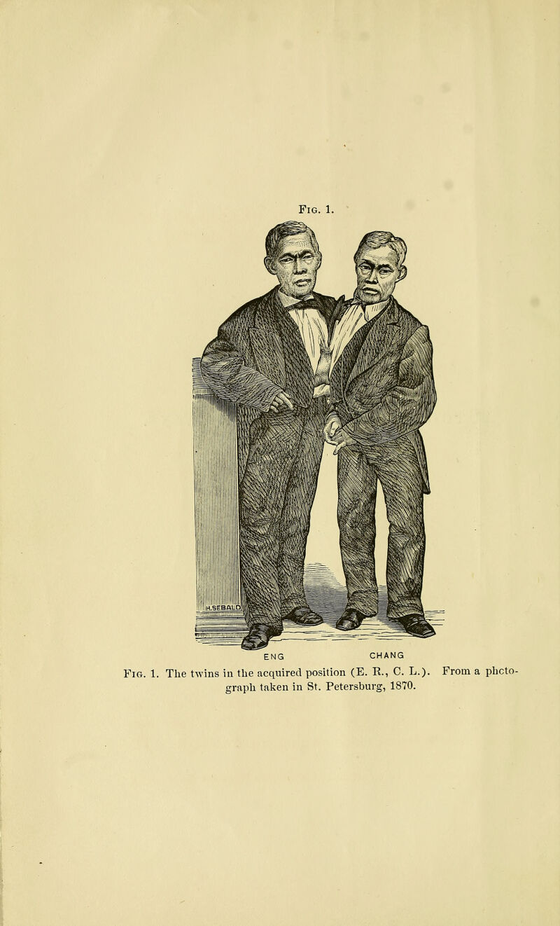 A --'^'^^^4!^ ~^^ ENG CHANG Fig. 1. The twins in the acquired position (E. R., C. L.). From a photo- graph taken in St. Petersburg, 1870.