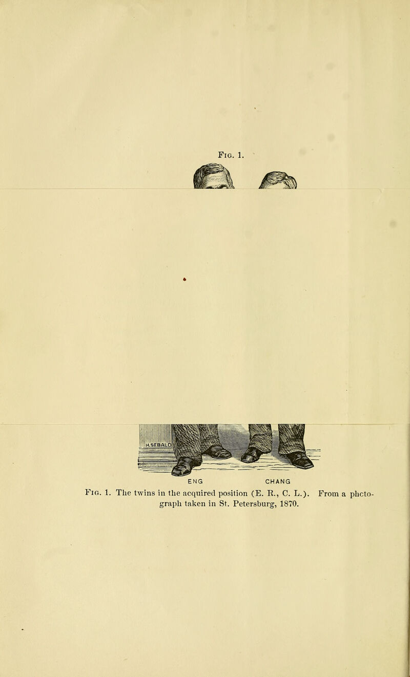 ENG CHANG Fig. 1. The twins iu the acquired position (E. R., C. L.). From a phcto- grapli talien in St. Petersburg, 1870.